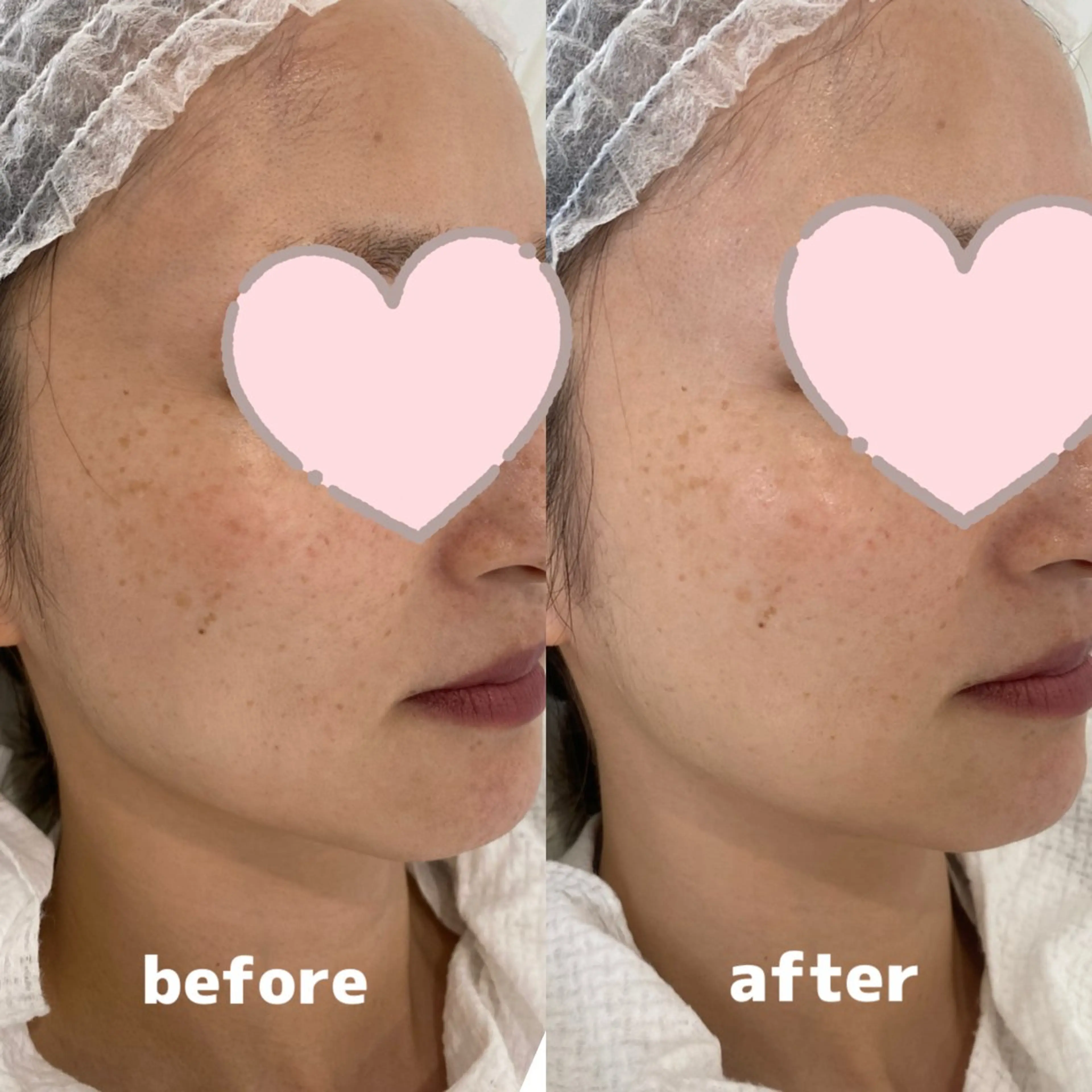 エステ Whitening Beauty 行橋店のその他イメージ