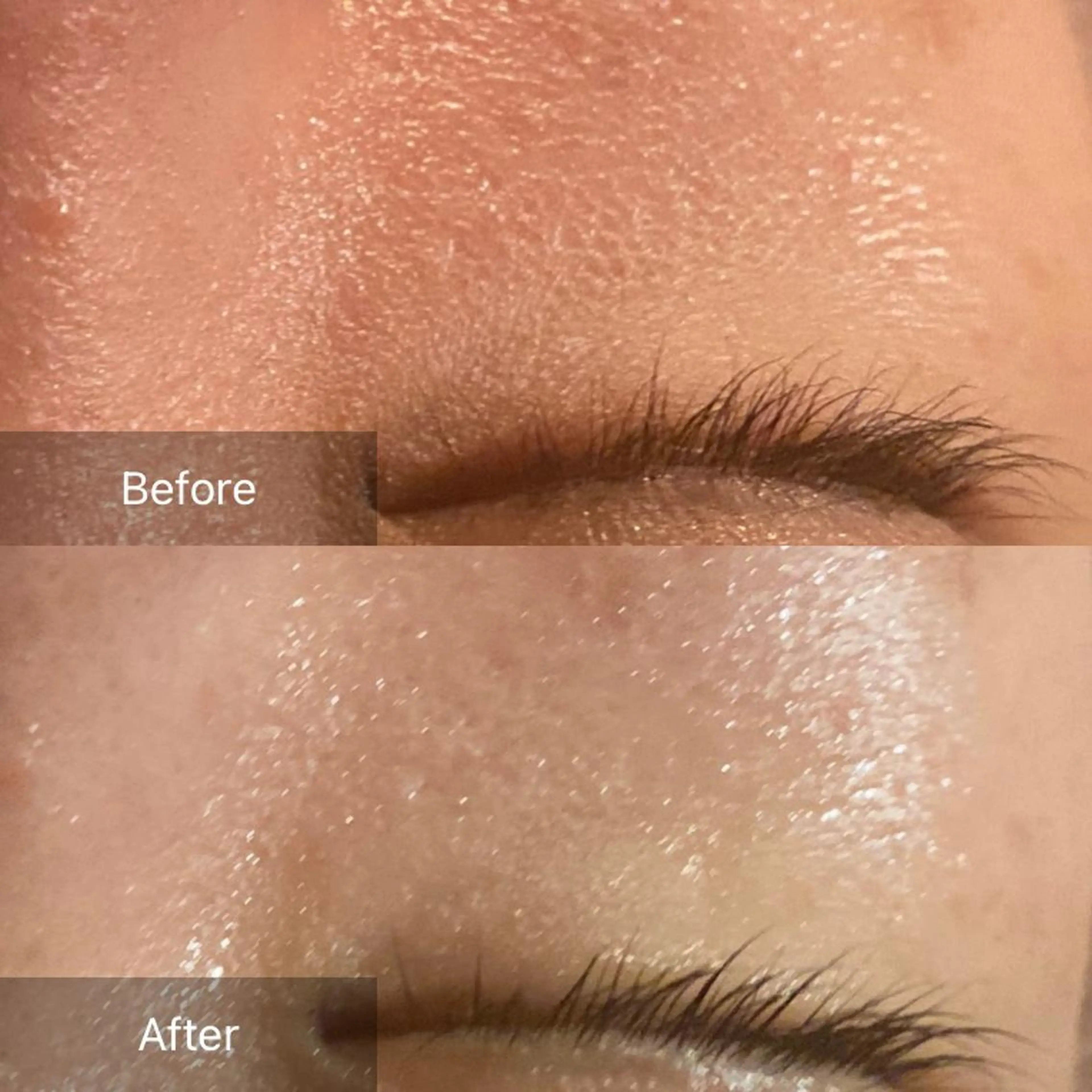 毛穴から始める肌メン テマンダリンオレンジのエステ・リラクイメージ