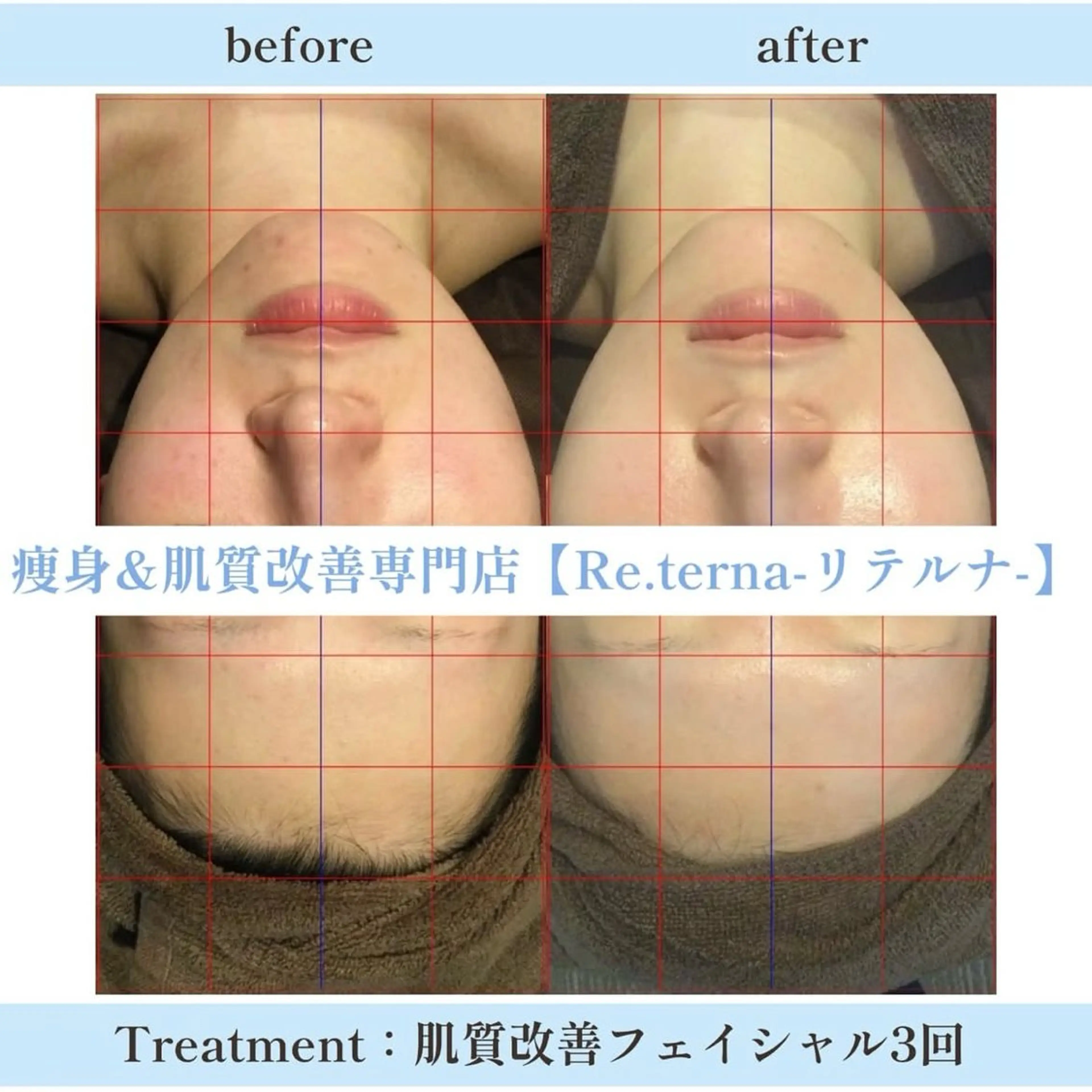 田辺🌿毛穴ケア サロンリテルナのエステ・リラクイメージ