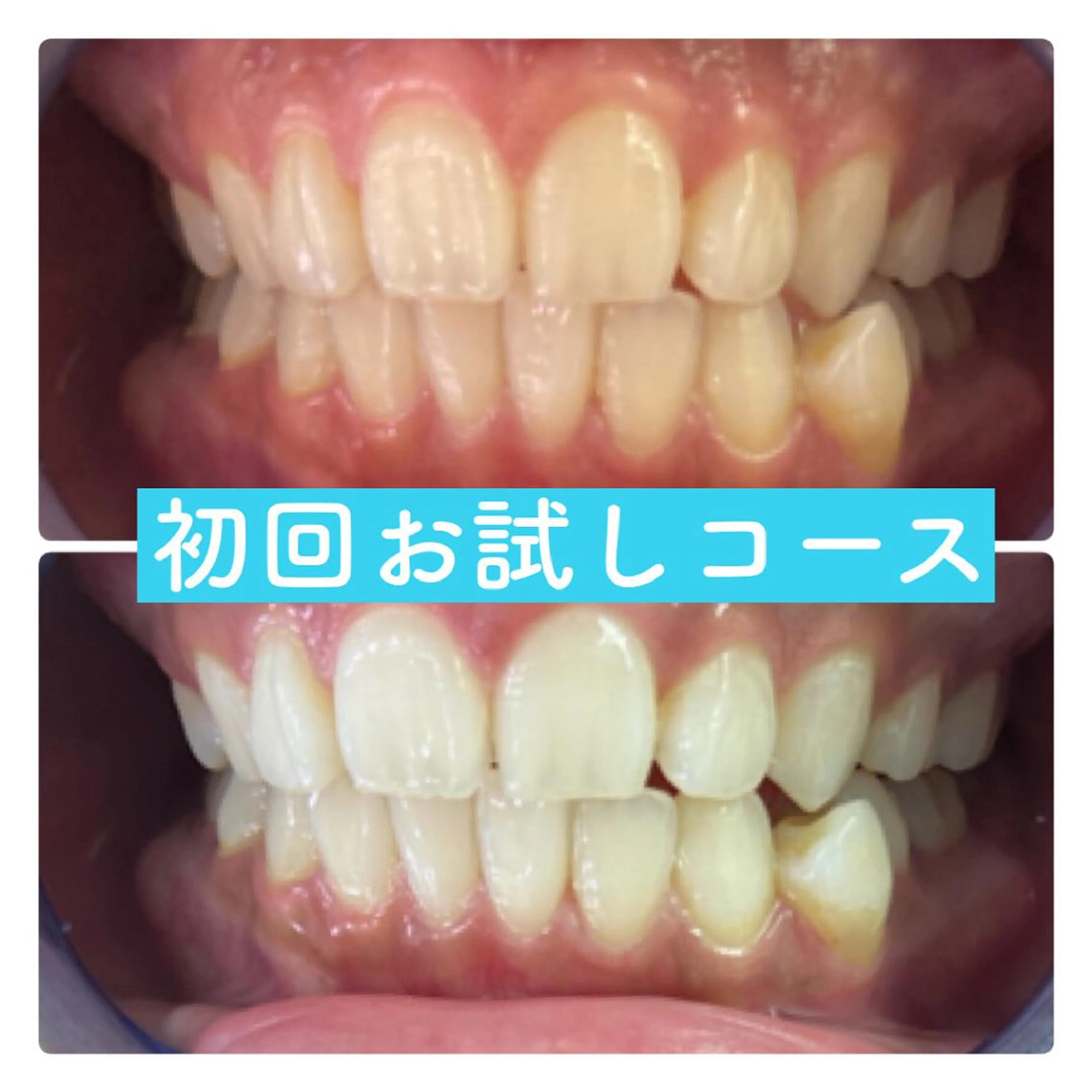 ホワイトニングルーム 横浜店のその他イメージ