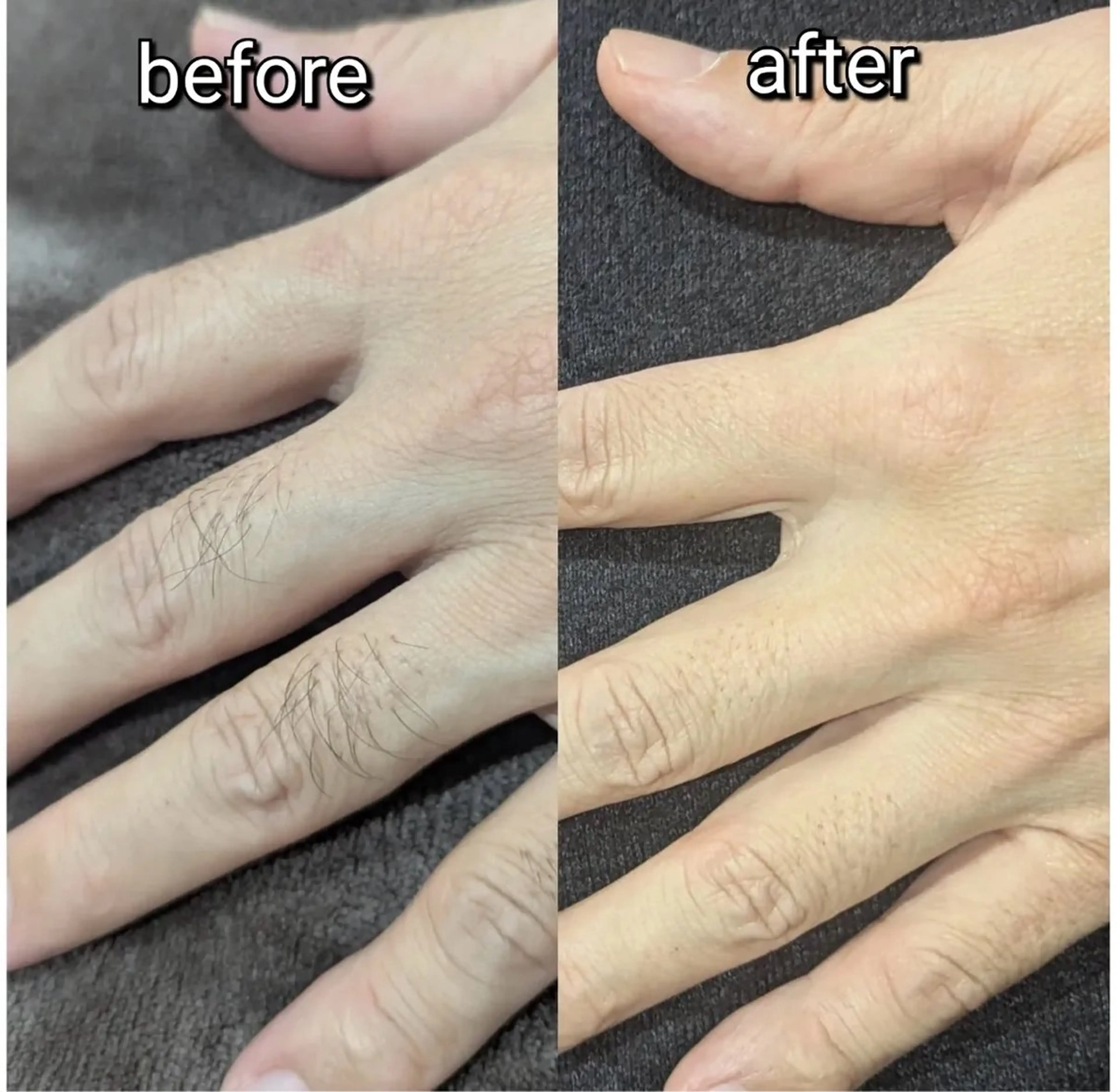 脱毛 RILsalon 脱毛/フェイシャルのエステ・リラクイメージ