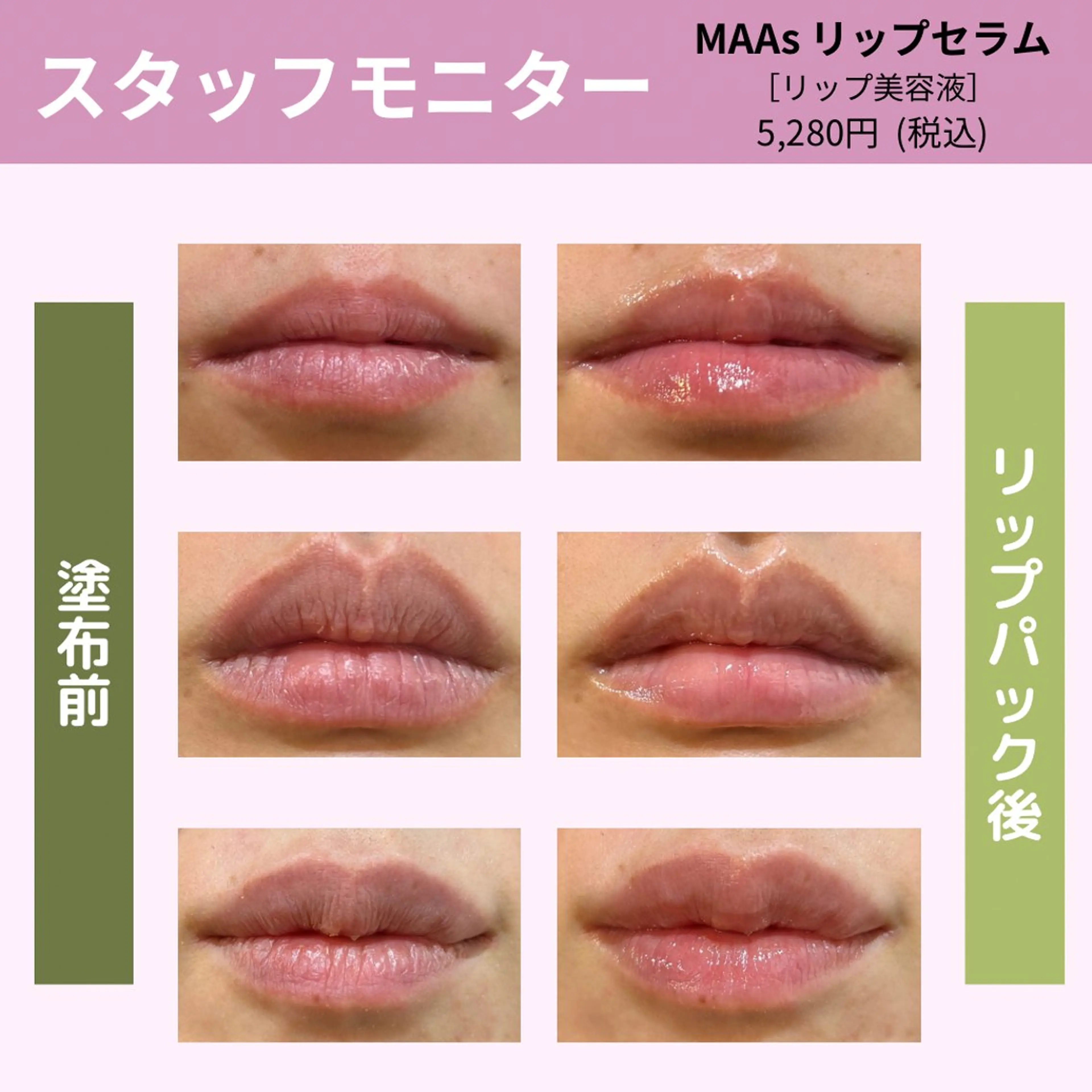 leolo武蔵浦和 肌質改善＆脱毛のエステ・リラクイメージ