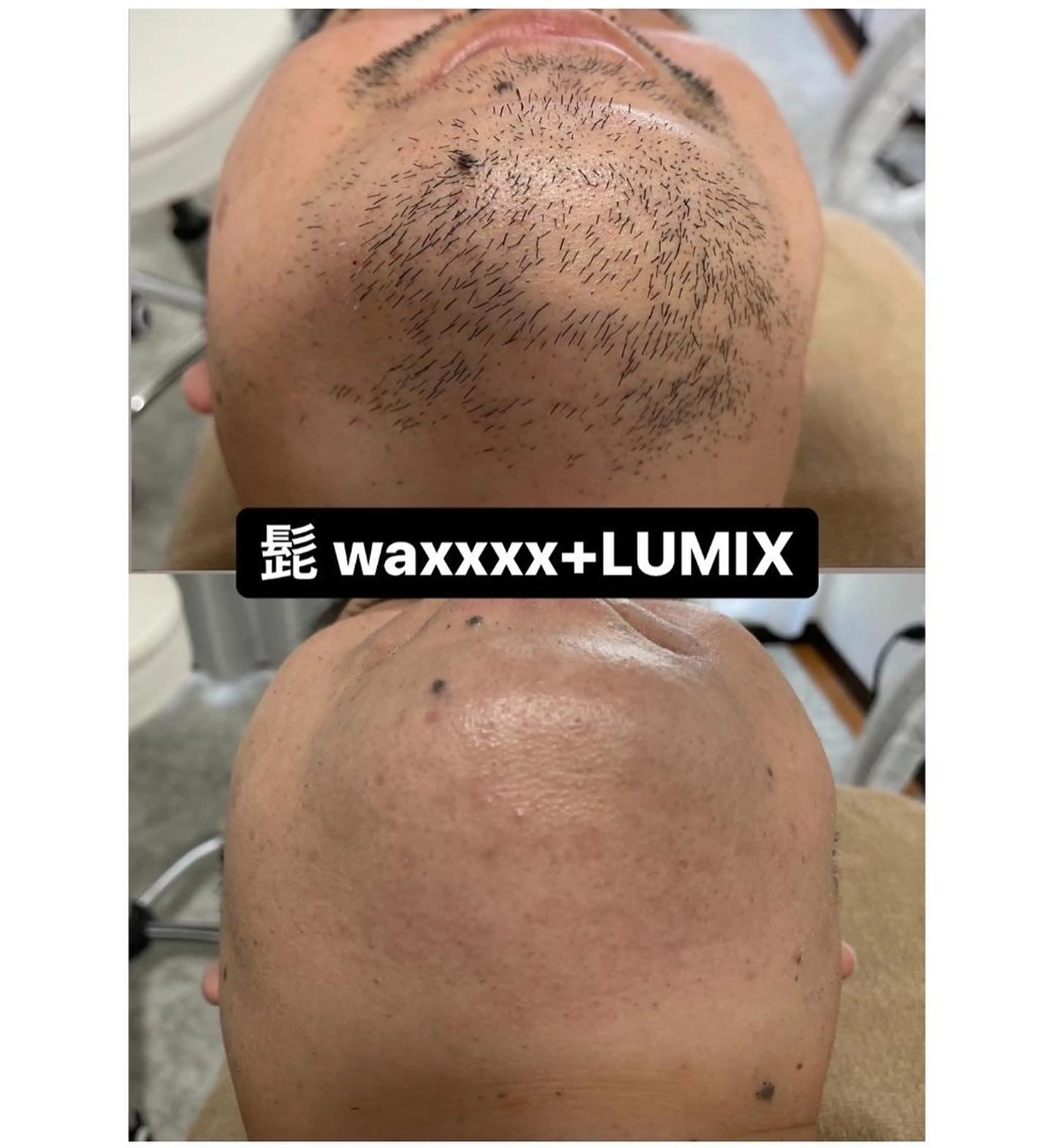 脱毛 Epina 千葉店 【エピナ】のエステ・リラクイメージ