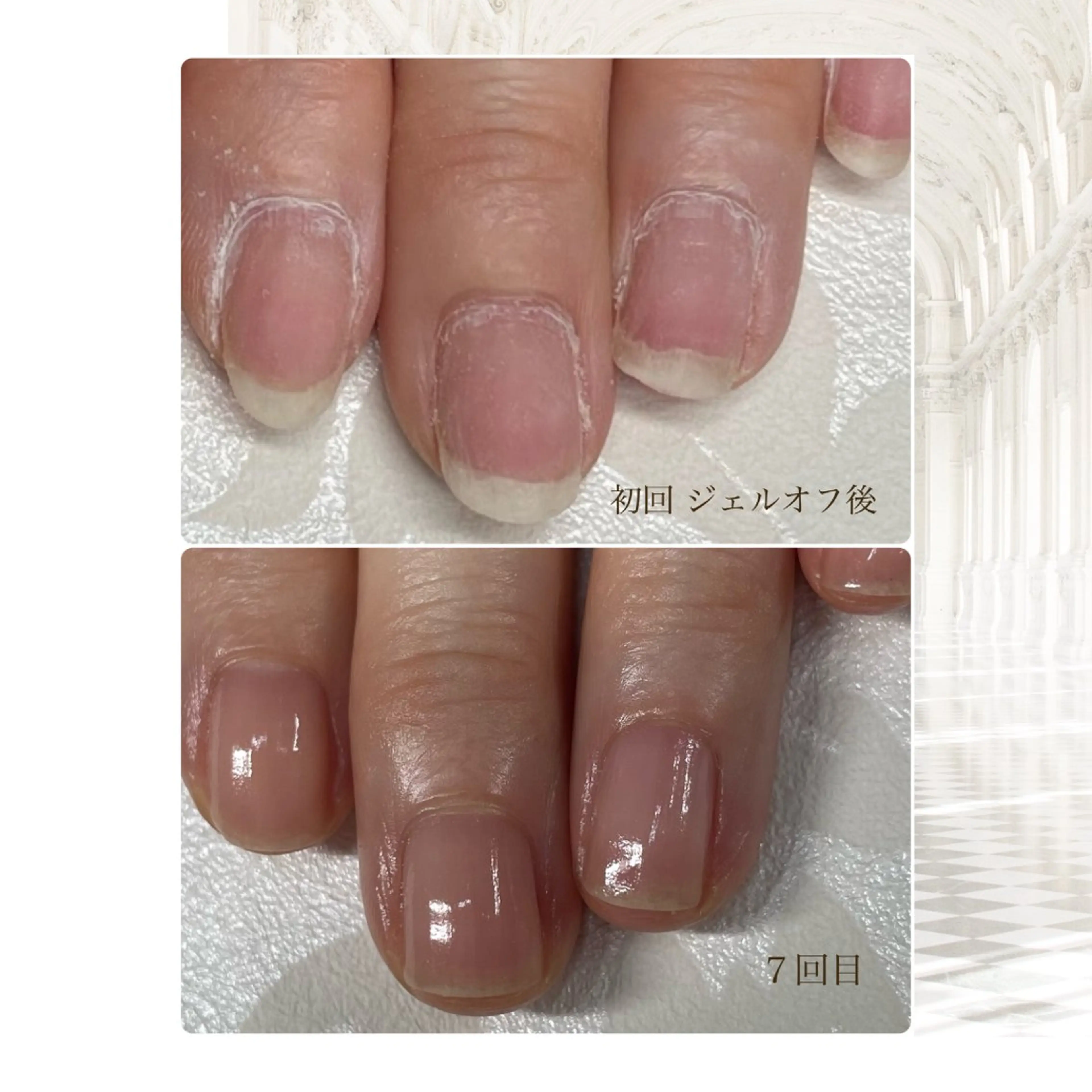 美爪育成お試しコースの写真