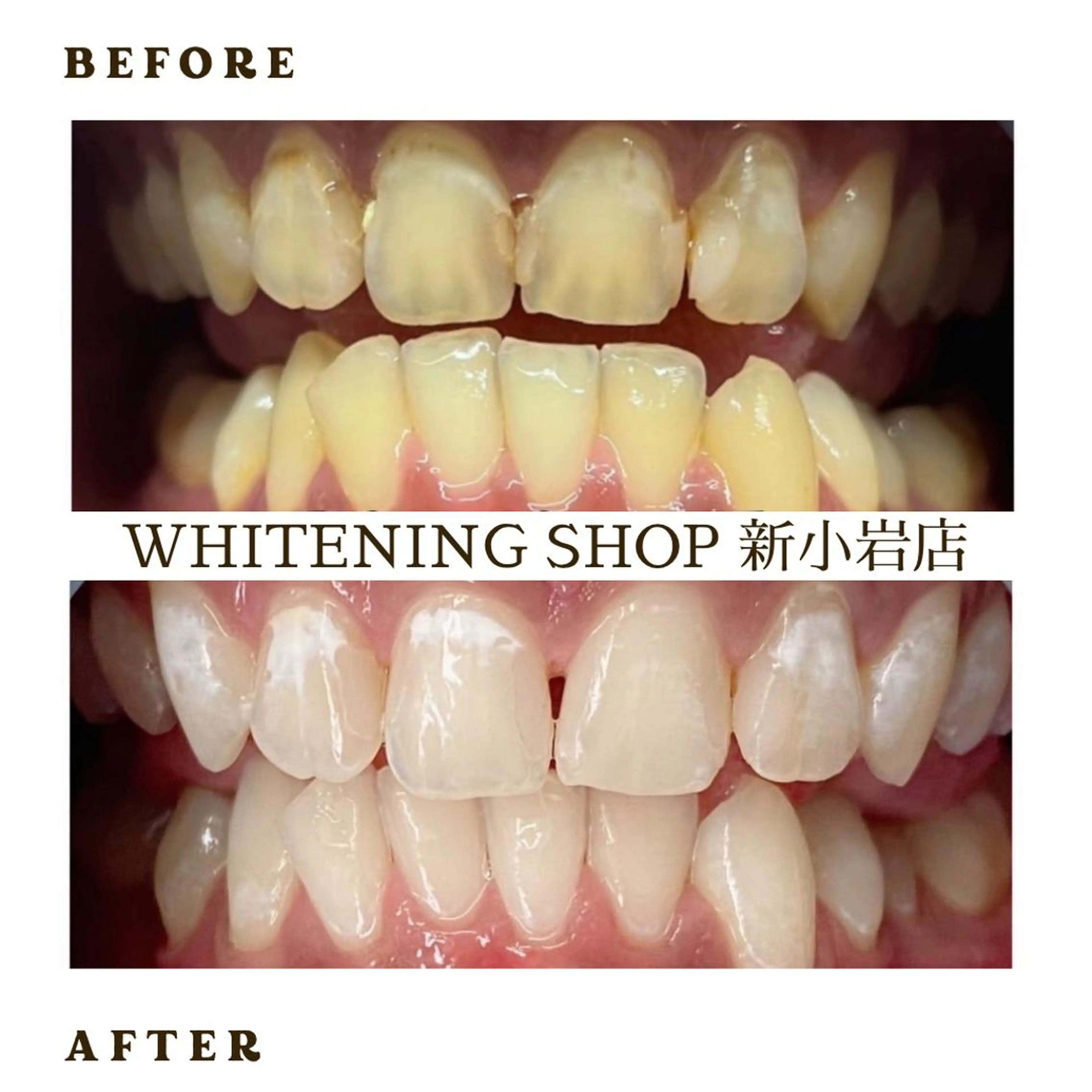 メンズ ホワイトニング ショップ新小岩店のその他イメージ