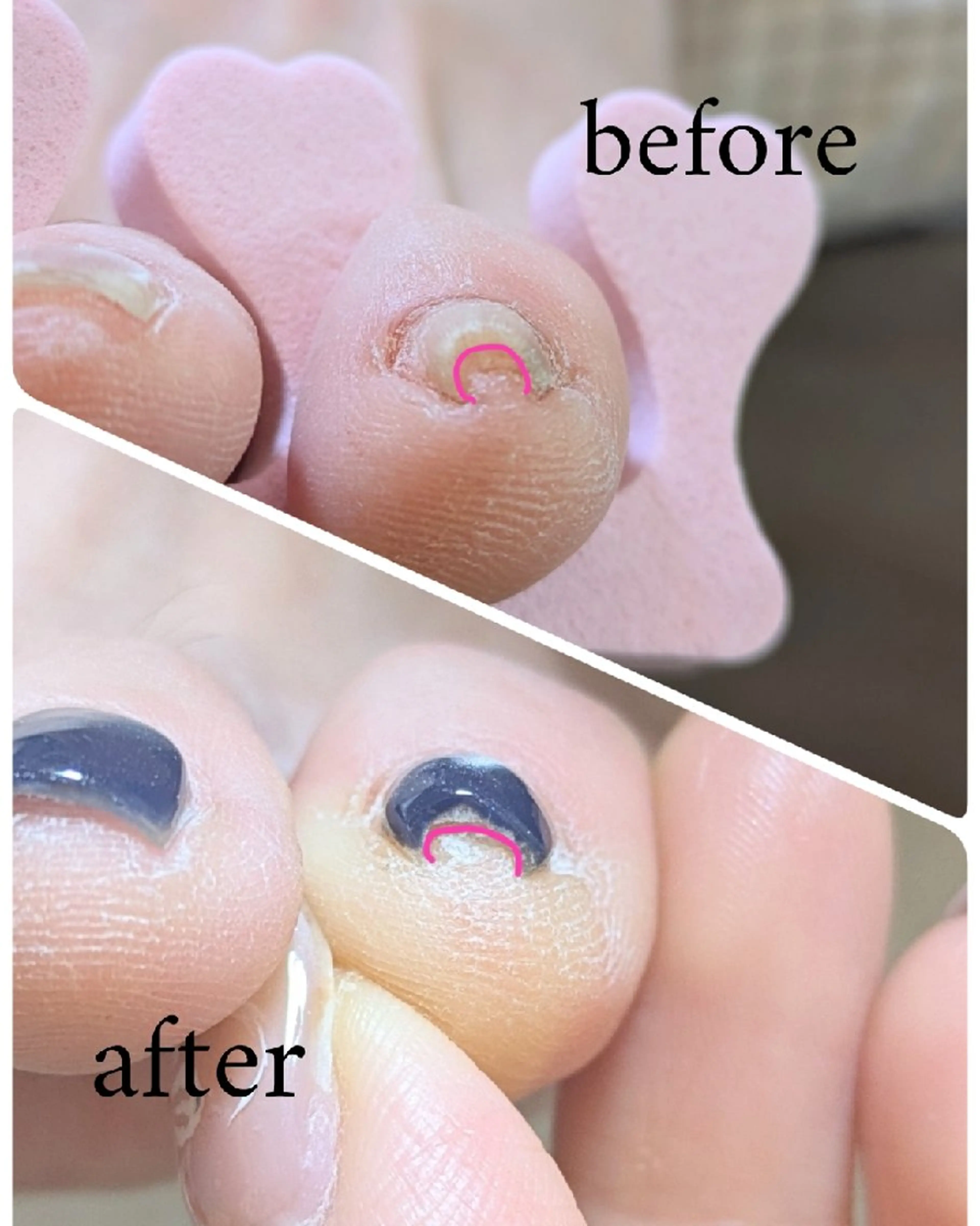 ネイル こもり さくらのネイルデザイン