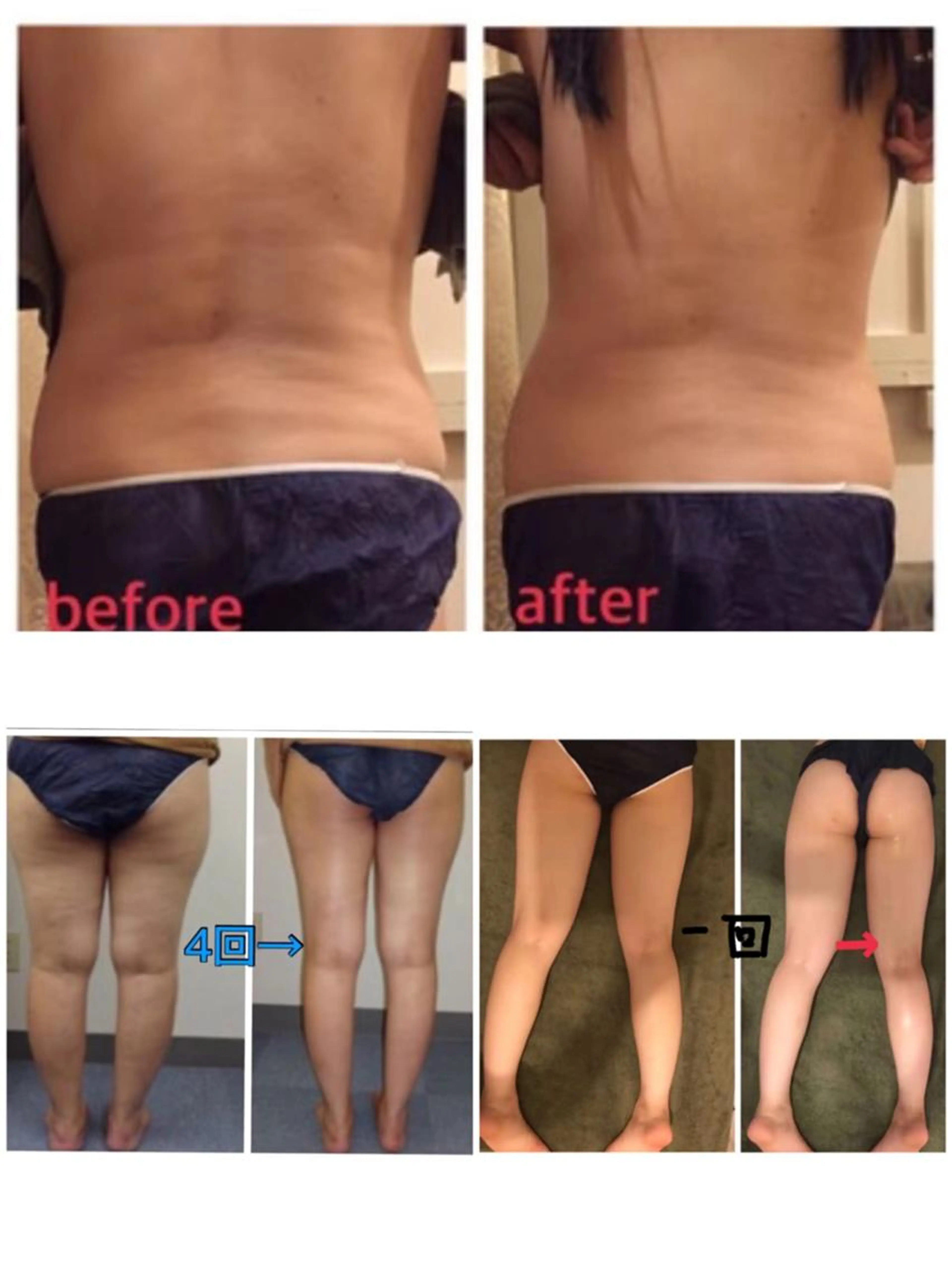 🌈大人気キャビテーション全身かけ放題🌈+筋膜リンパマッサージ+ヘッドスパ120分の写真