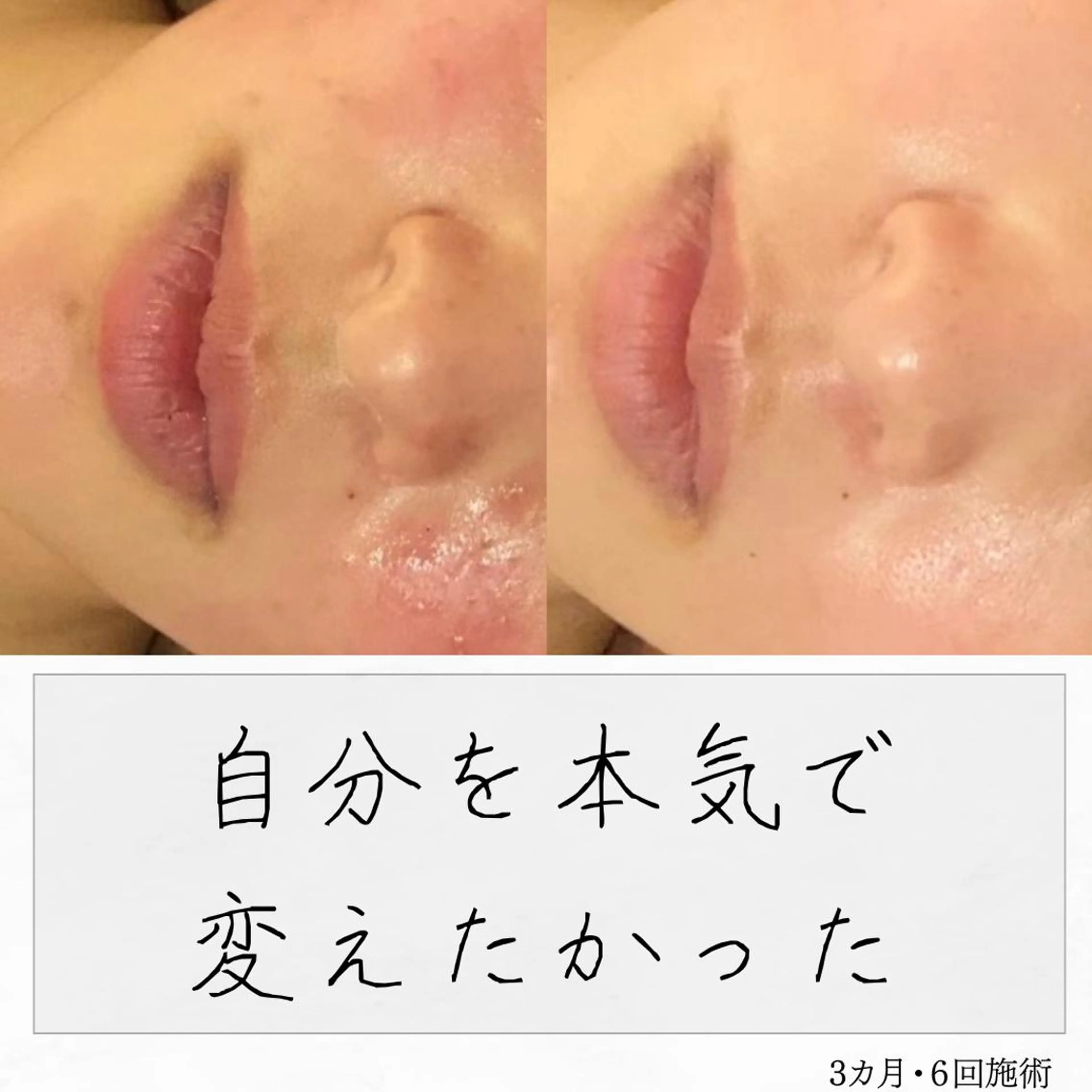 ニキビ経験者が施術 する専門サロン🌻のエステ・リラクイメージ