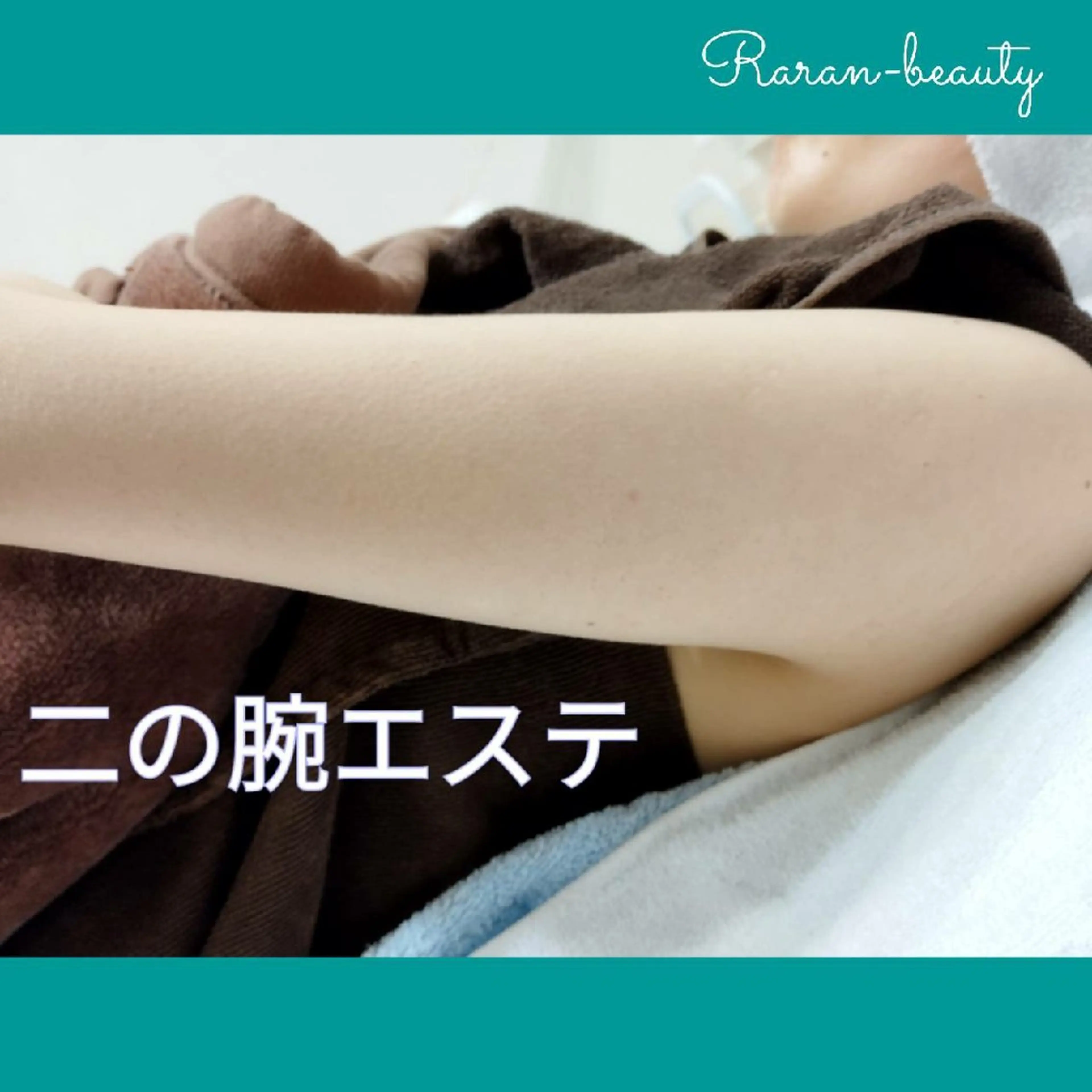 💐花嫁様🎉【二の腕ブライダルエステ(炭酸引き締め二の腕ケア)】＆無料相談コースの写真