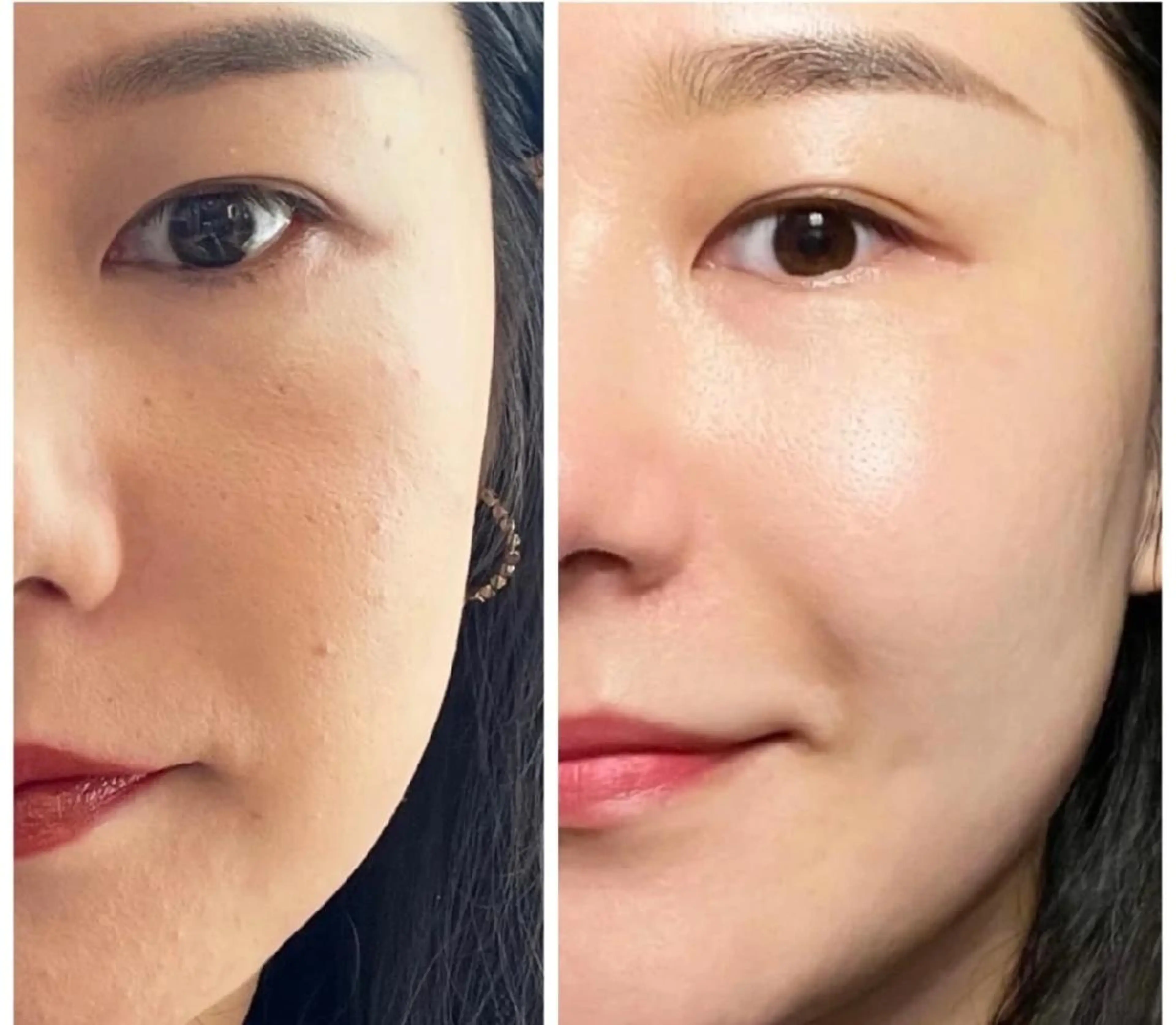 aliaハーブ水光店 エステティシャン募集のエステ・リラクイメージ