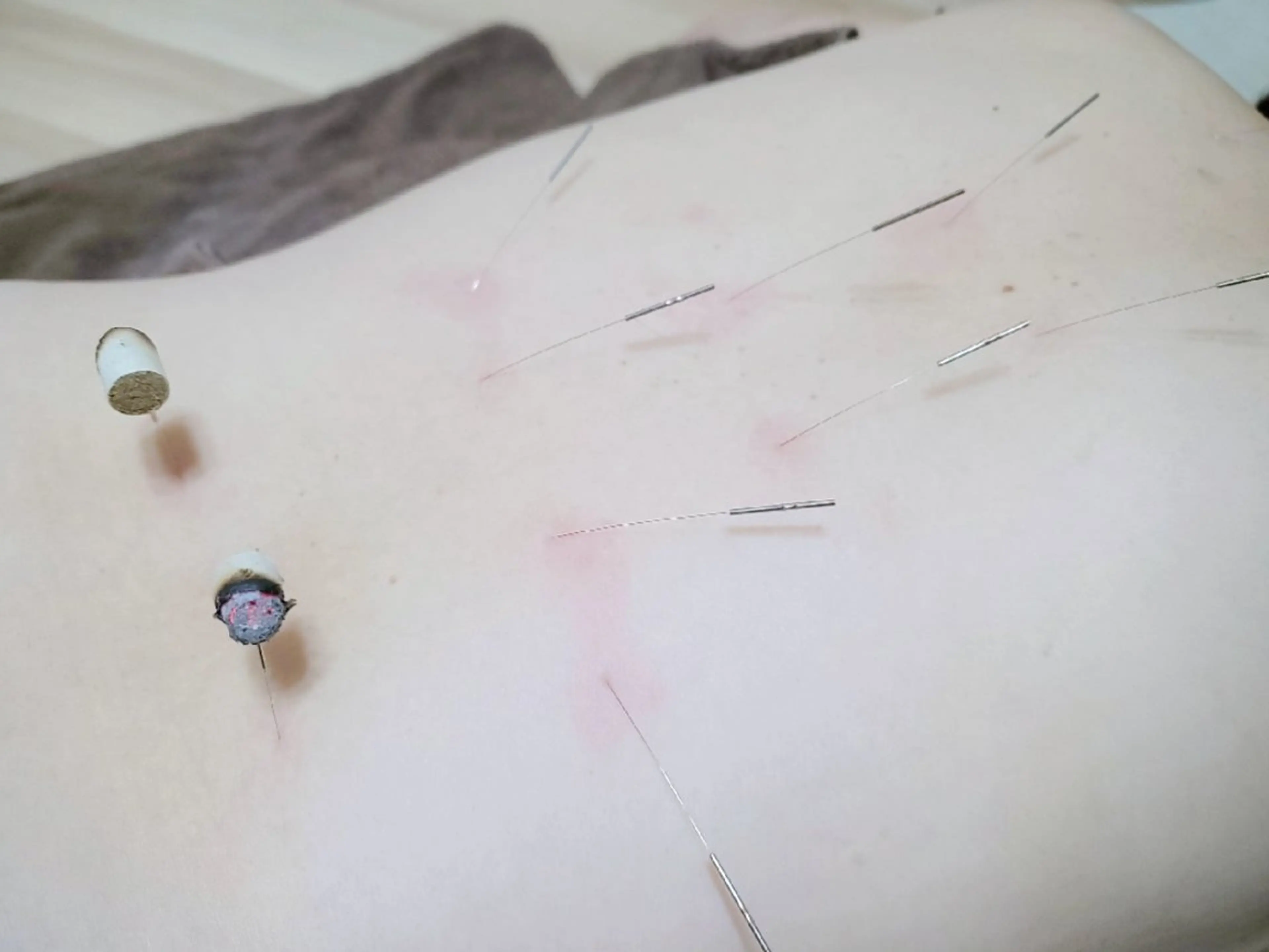 リラク 温活×自律神経  鍼灸Amaterasのエステ・リラクイメージ