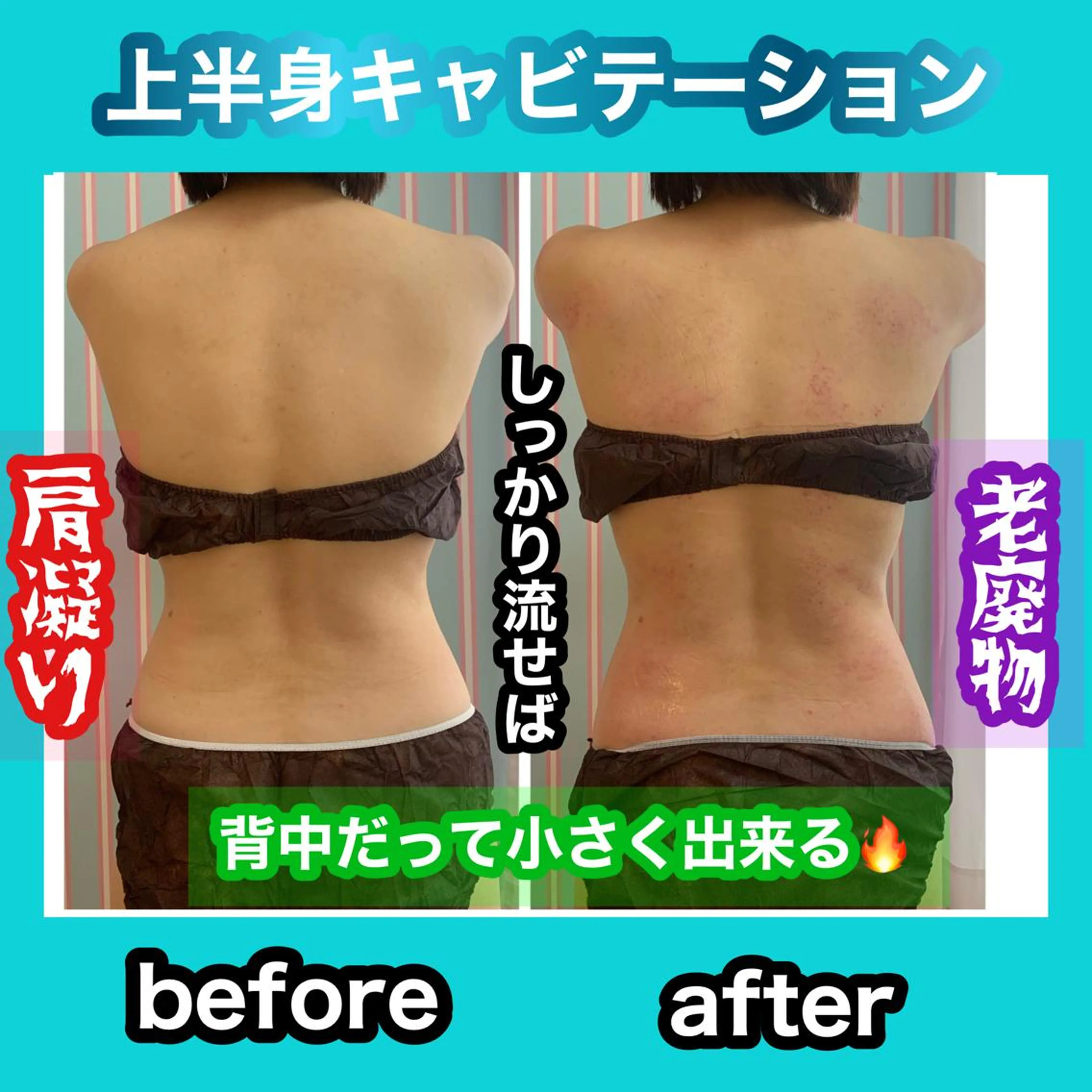 エステ リラク 痩身/脱毛/ネイル HARUKAのエステ・リラクイメージ