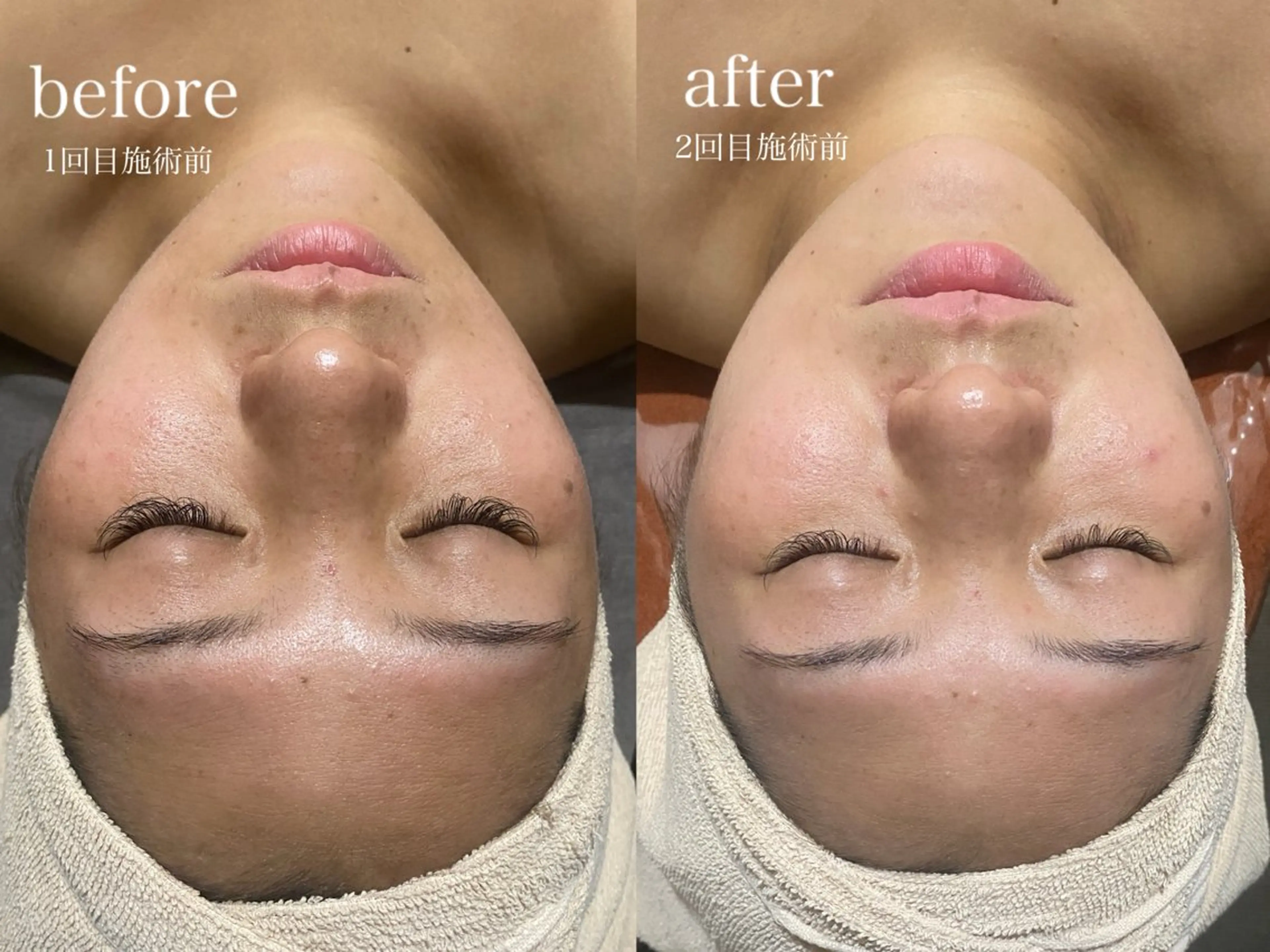 エステ サロン・ド・ポラリス所属・サロンド ポラリスのエステ・リラクイメージ