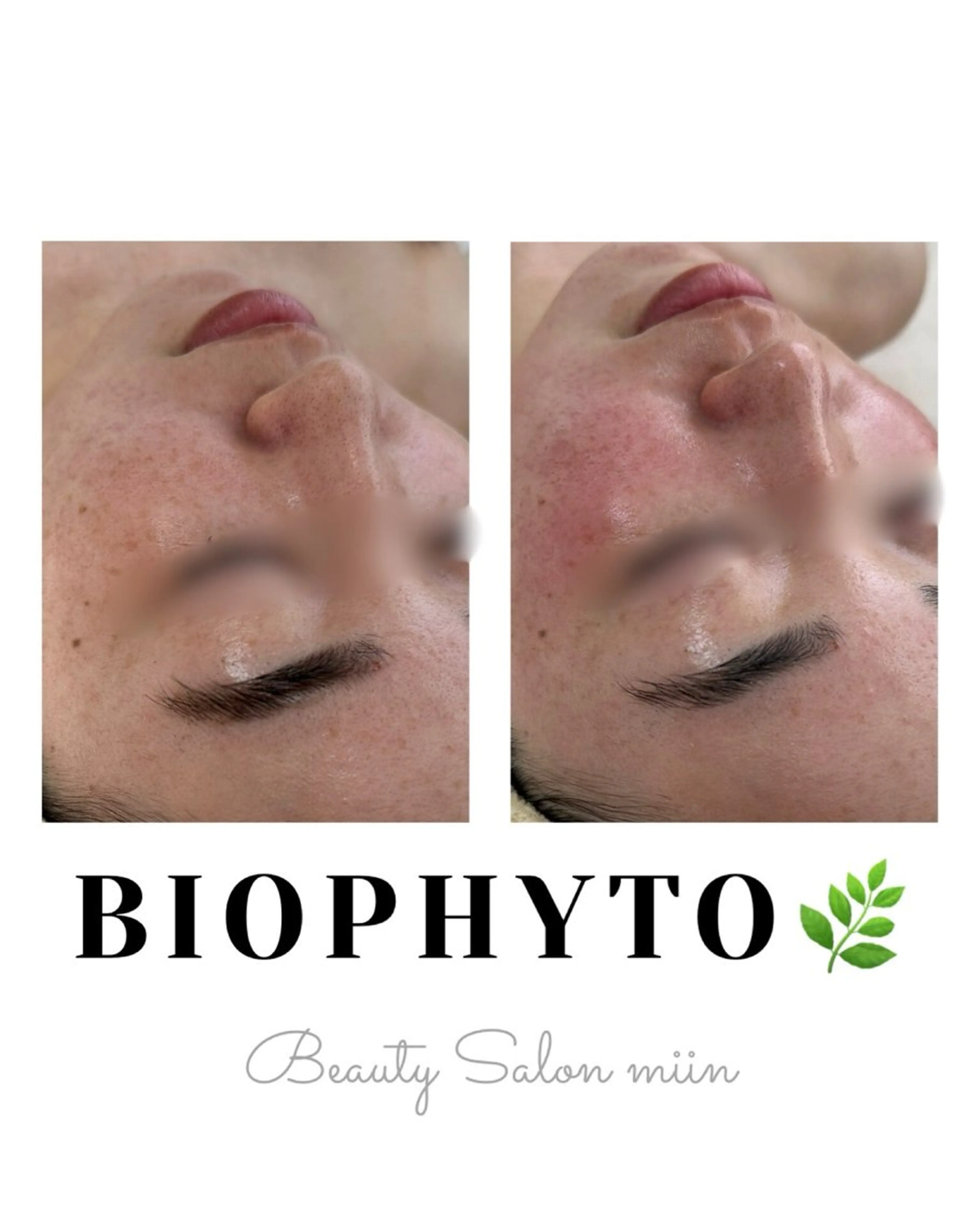 リラク 韓国肌管理 白玉肌管理®︎のエステ・リラクイメージ