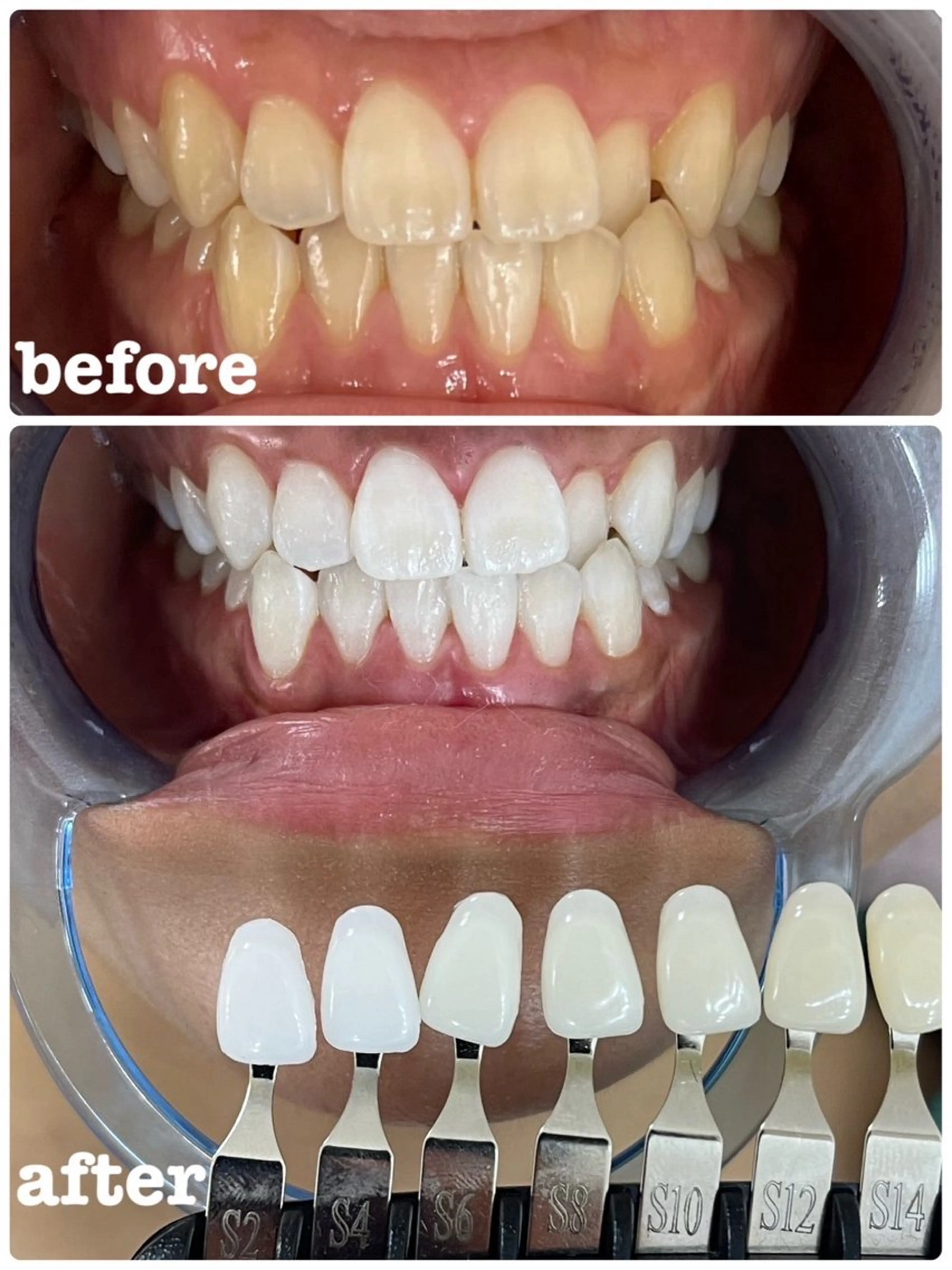 セルフホワイトニング エクシア徳島店マユのその他イメージ