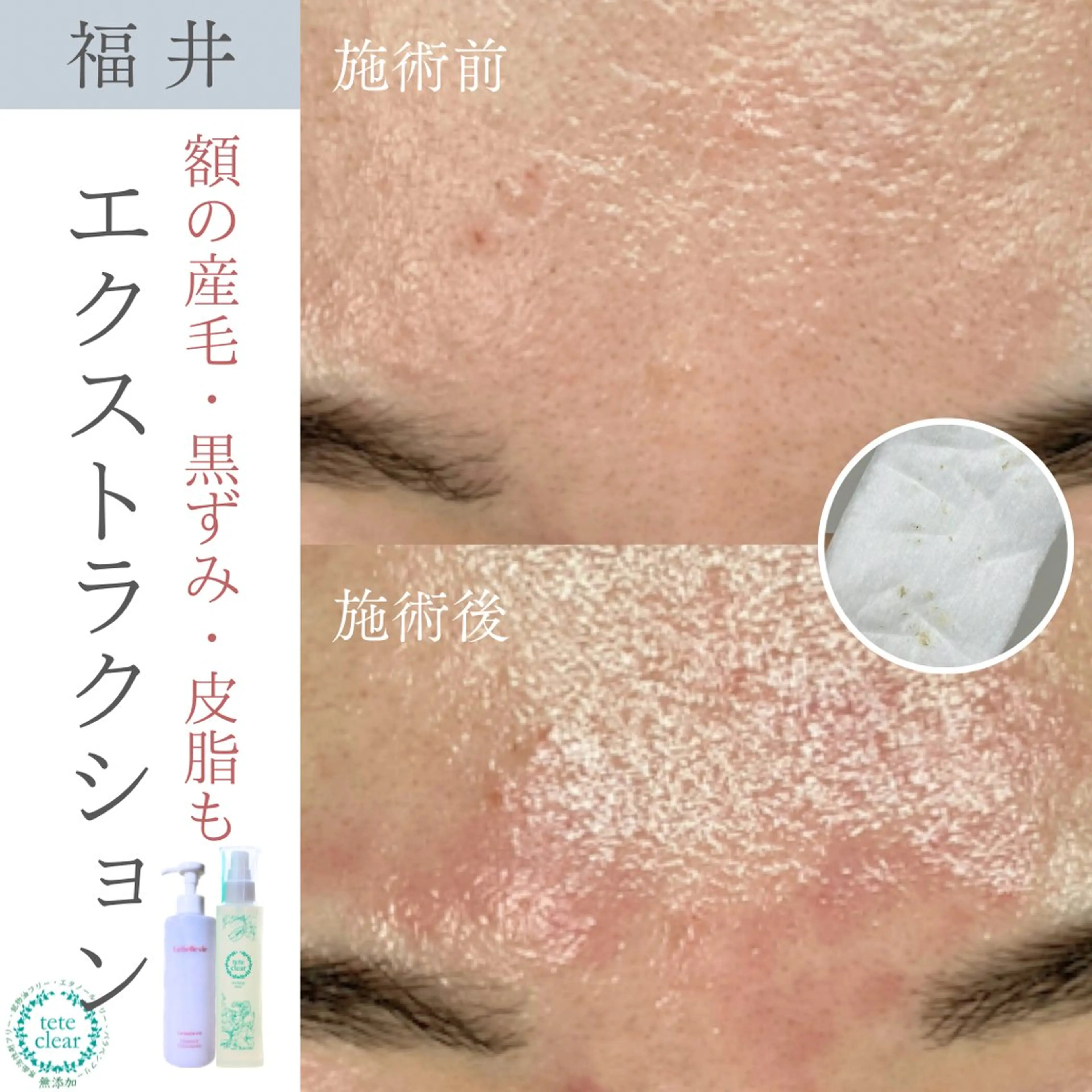 毛穴肌質ケアサロン Yourmeユアミーのエステ・リラクイメージ