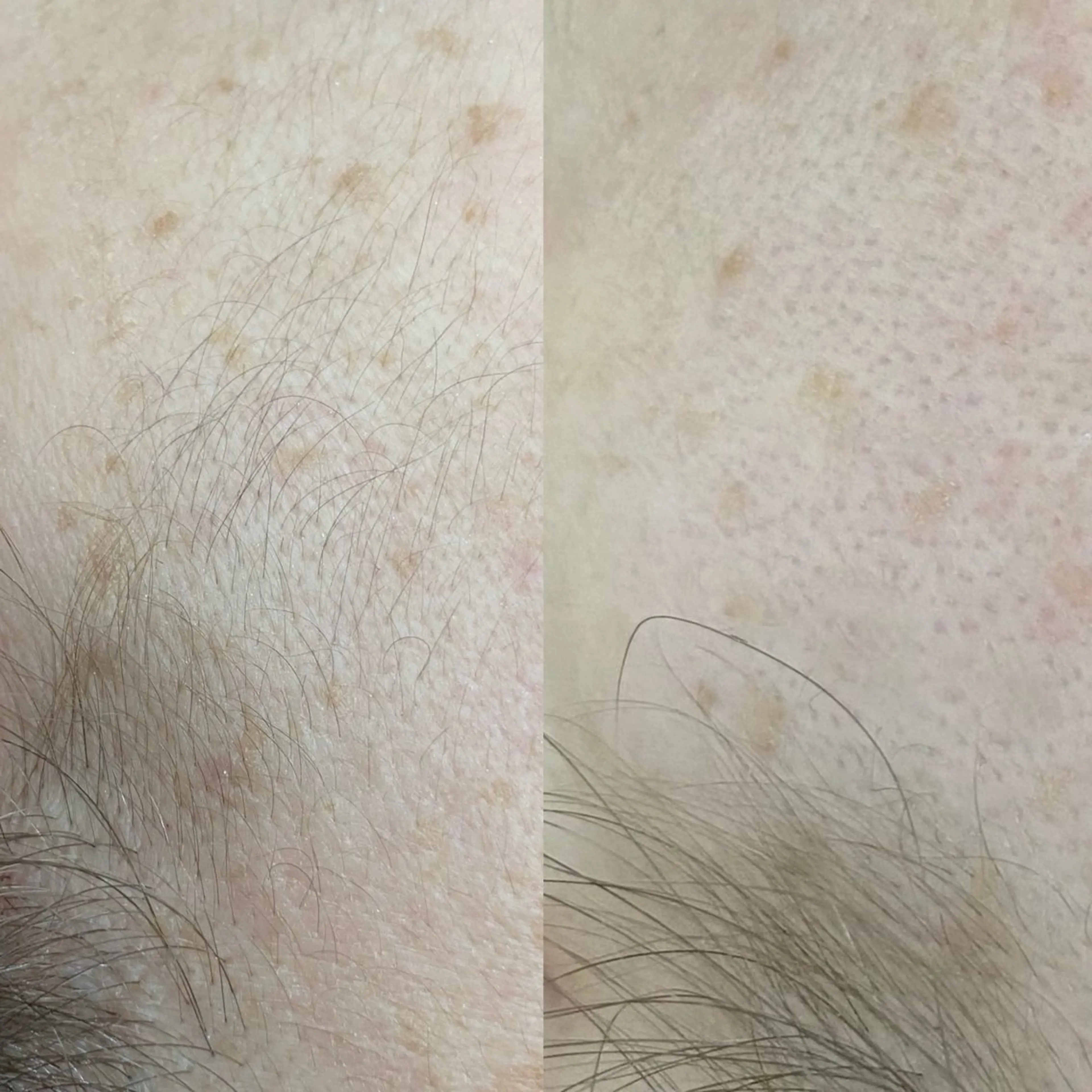 脱毛 &me ayakaのエステ・リラクイメージ