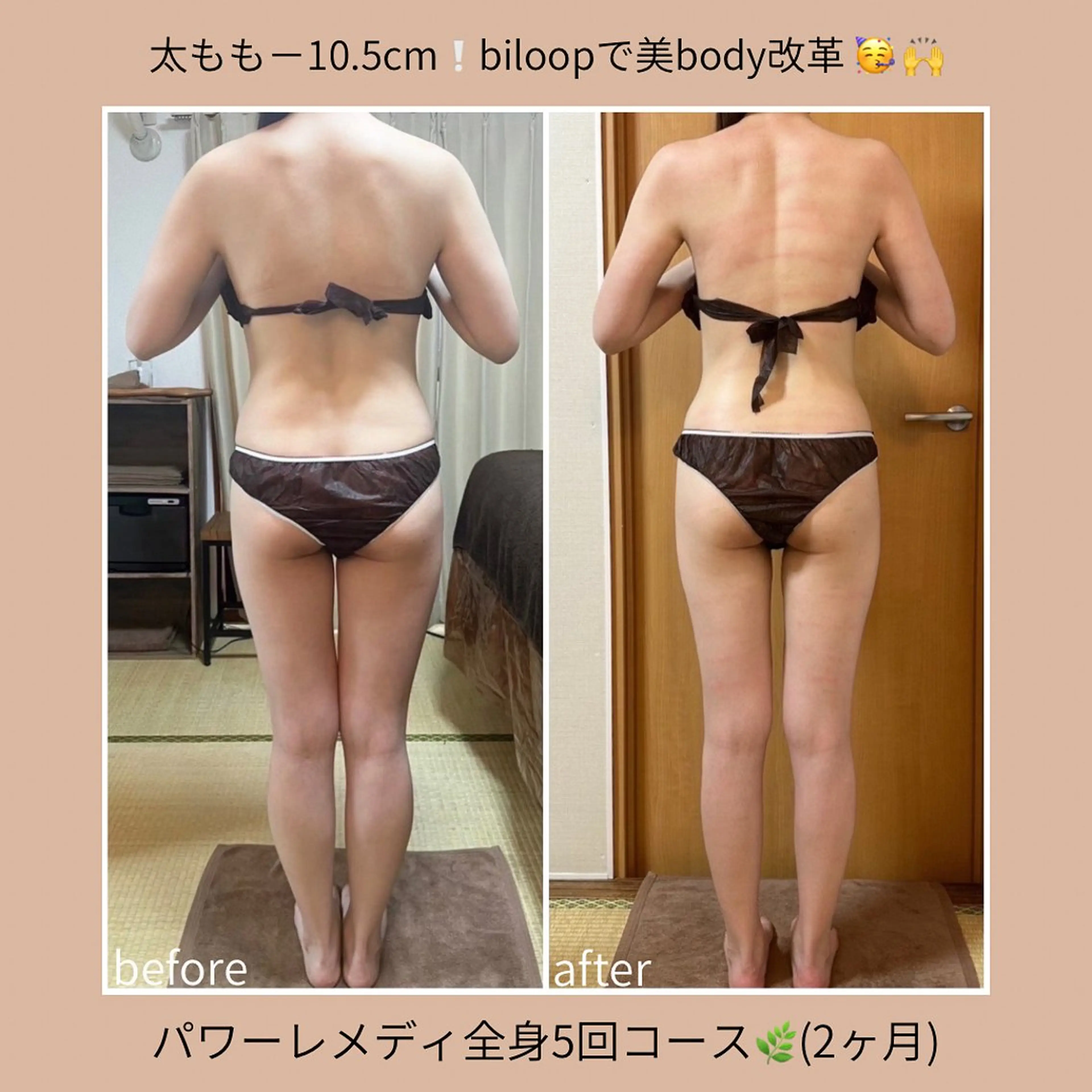 biloop所属・《本気痩せ×疲労改善 》  BILOOPのエステ・リラクイメージ