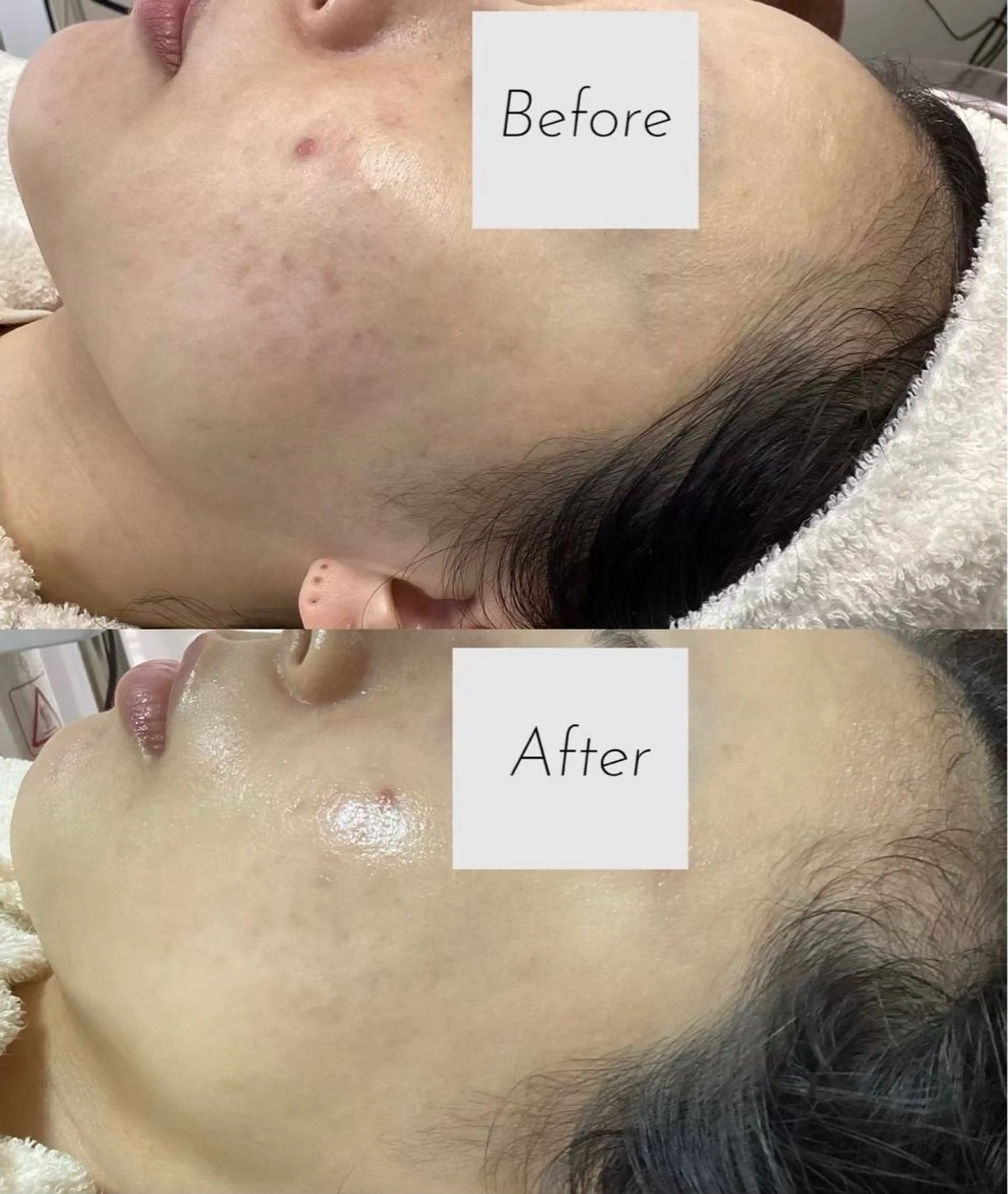 エステ 都度払い 肌質改善専門サロンのエステ・リラクイメージ