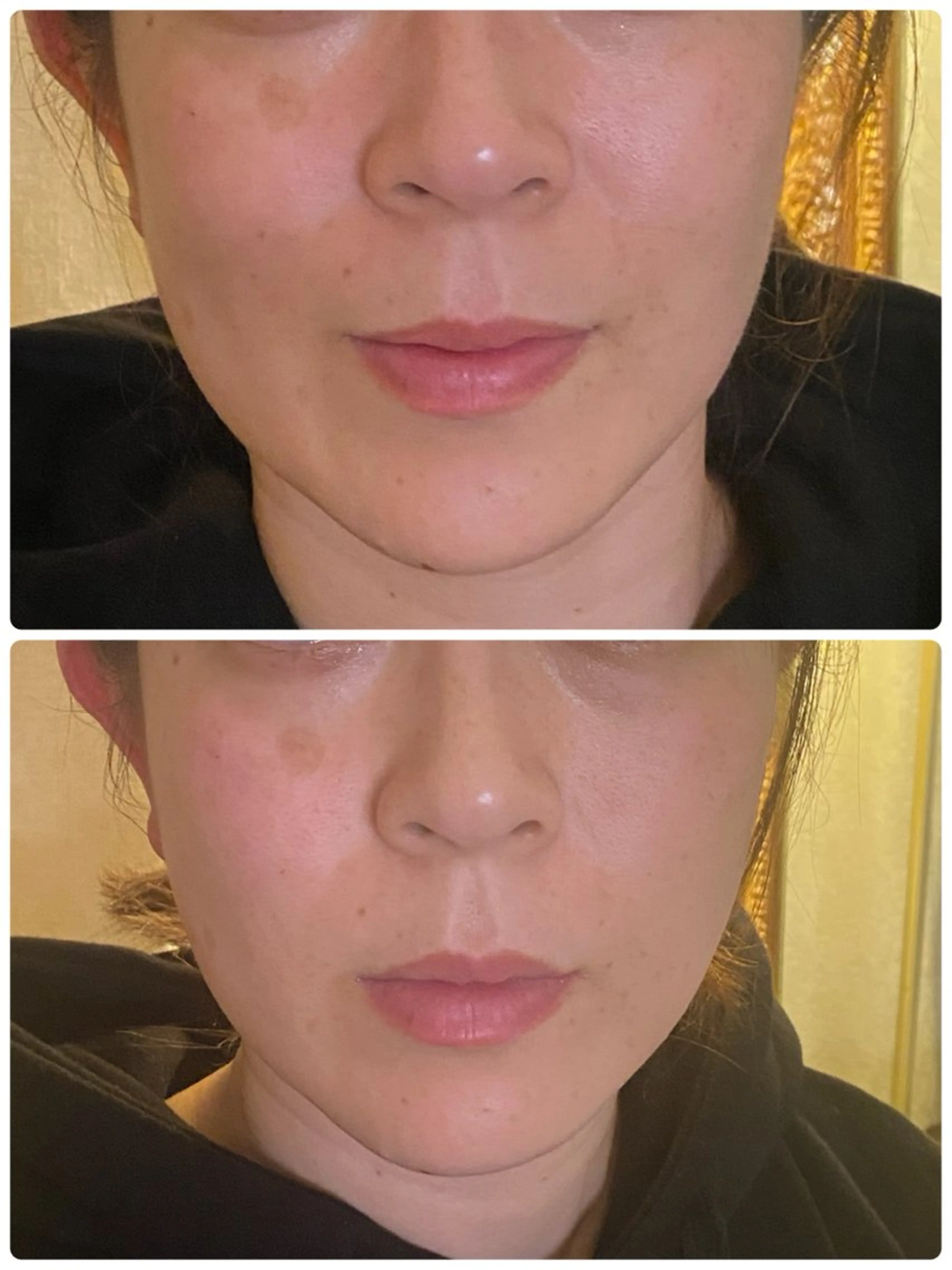 天神美容鍼99 -KUKU-吉弘萌香のエステ・リラクイメージ