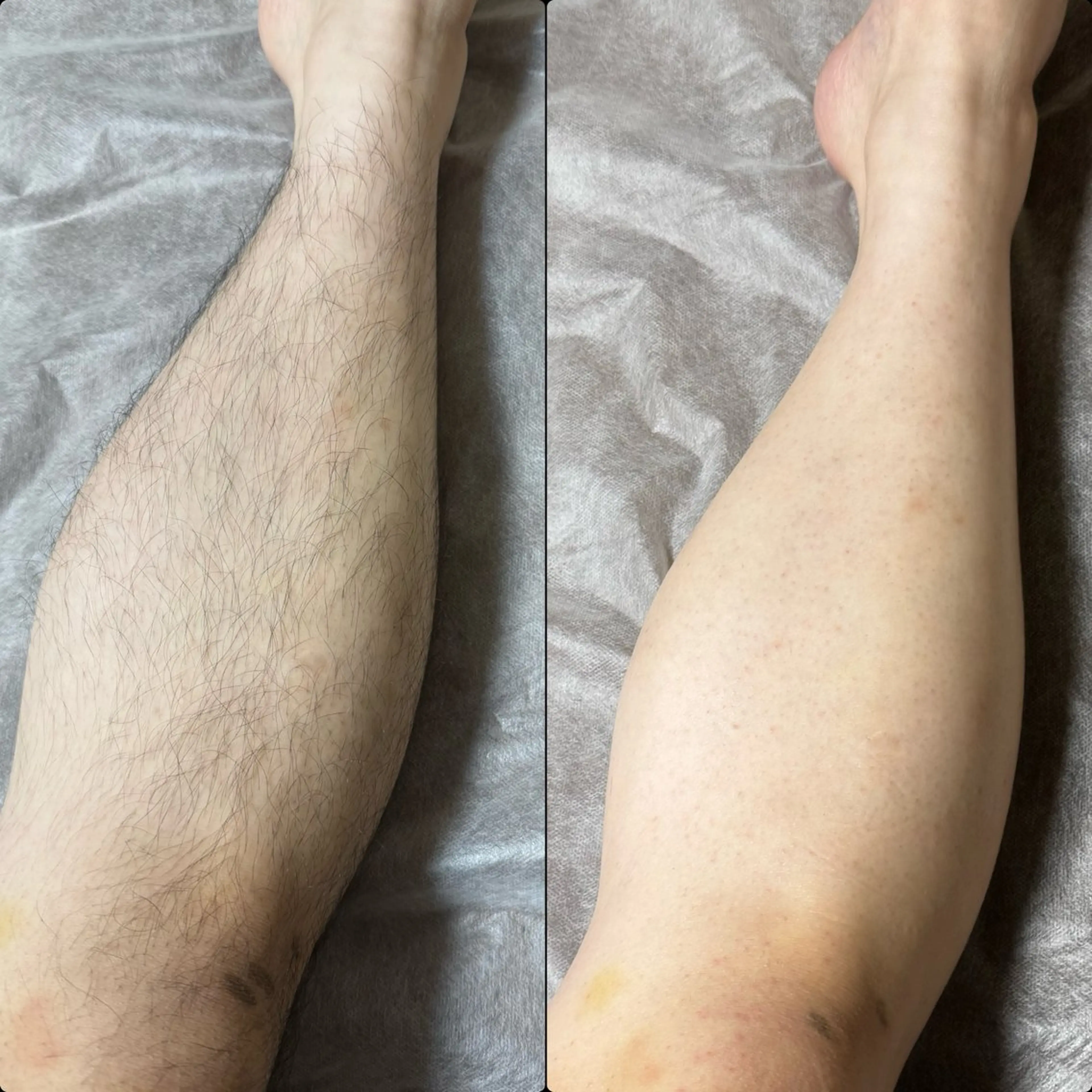 脱毛 六本木脱毛andS 店長Sachiのエステ・リラクイメージ