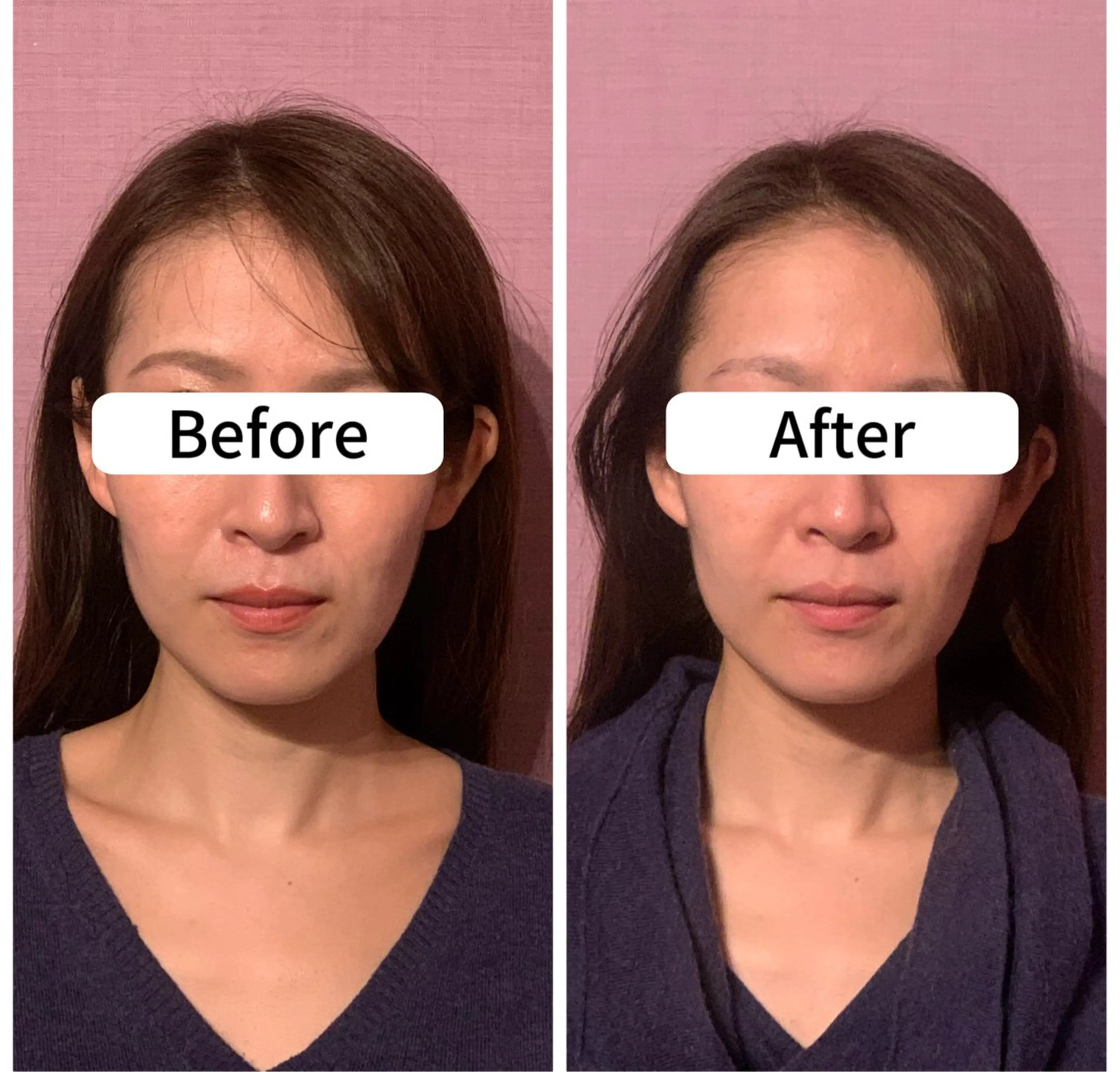 アンベリーノ Yuuriのエステ・リラクイメージ