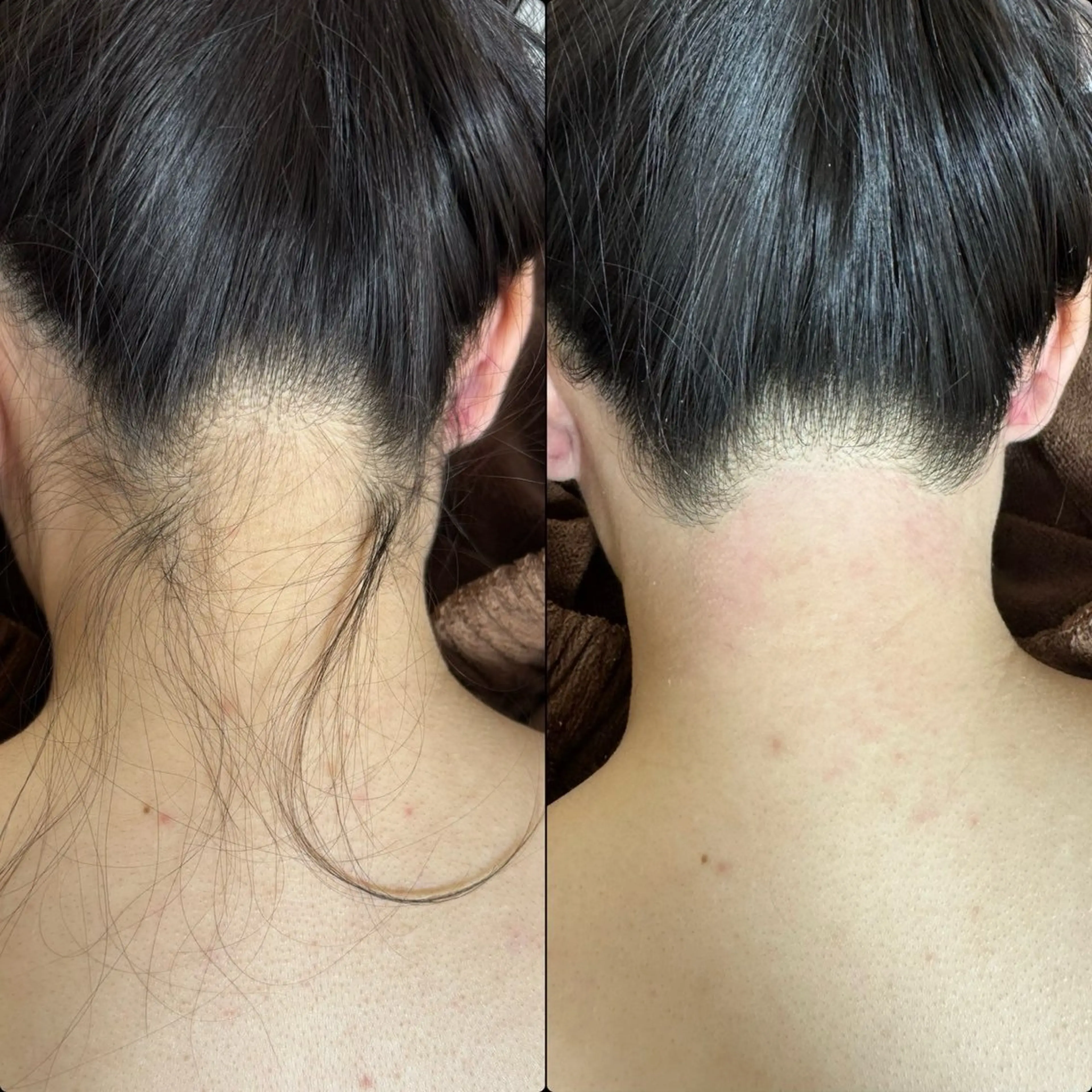 六本木脱毛andS さおりのエステ・リラクイメージ