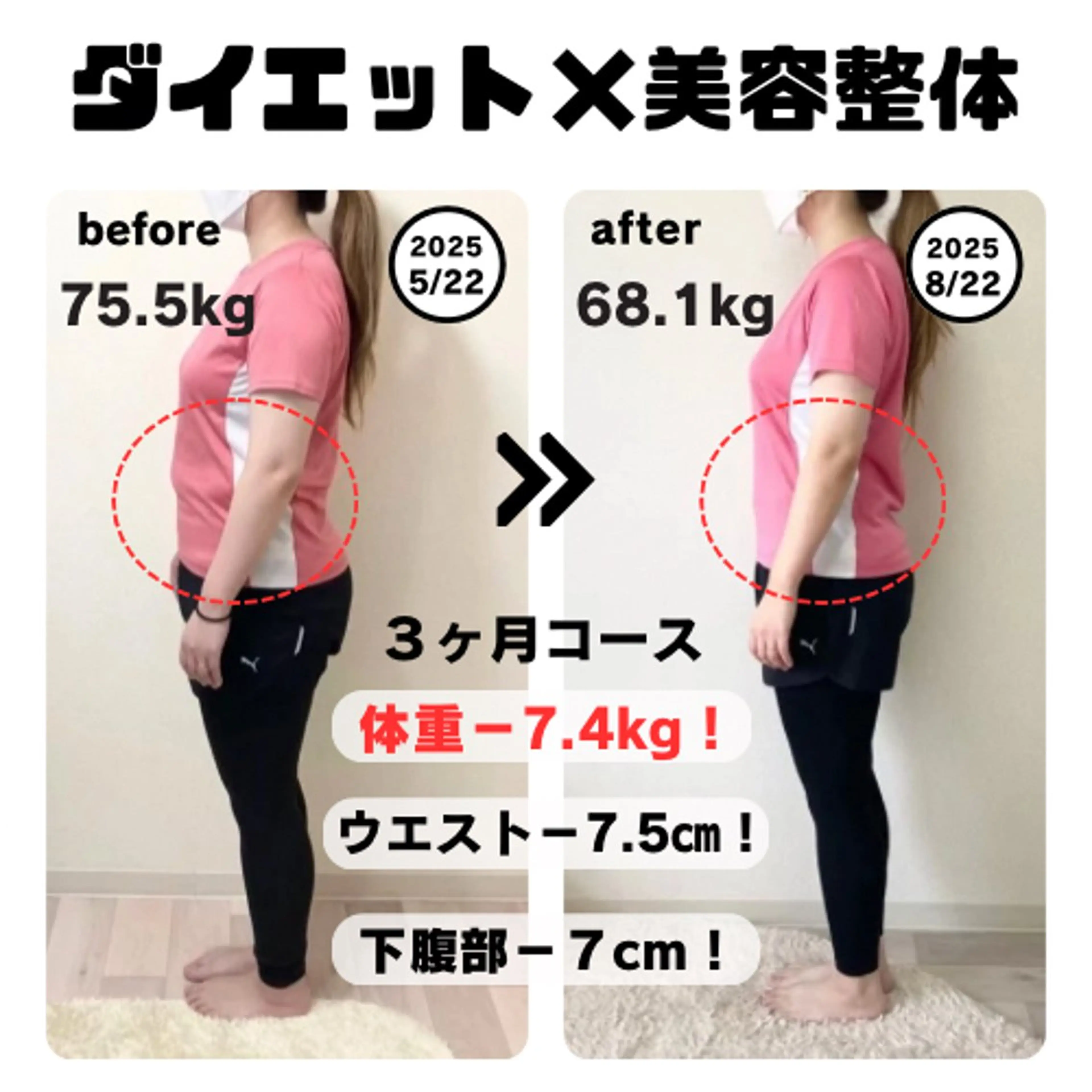 【今60kgで5kg以上痩せたい方限定】ヴレ式ダイエット×痩身整体カウンセリングの写真