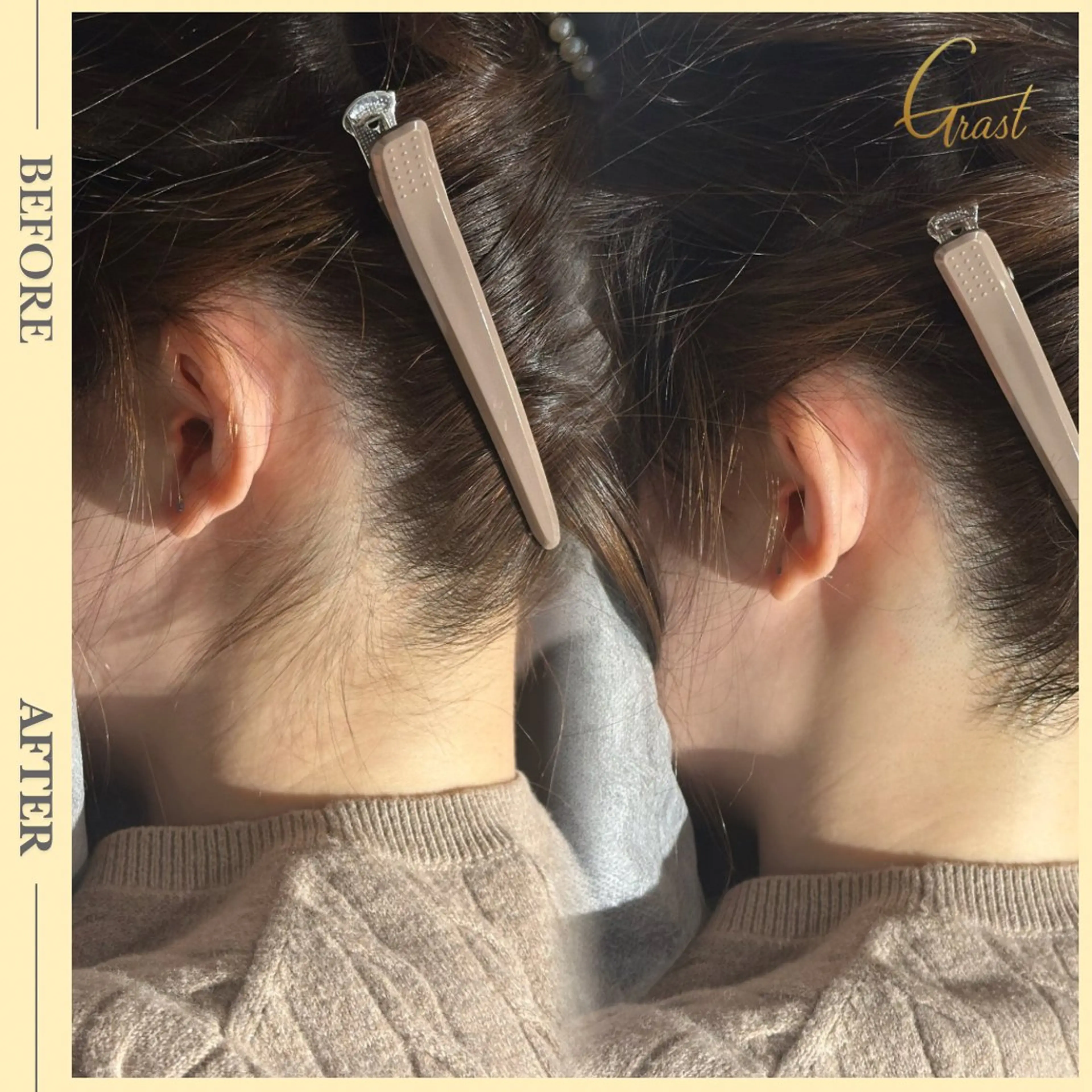 ツヤ肌脱毛サロン Grast🌿アイカのエステ・リラクイメージ