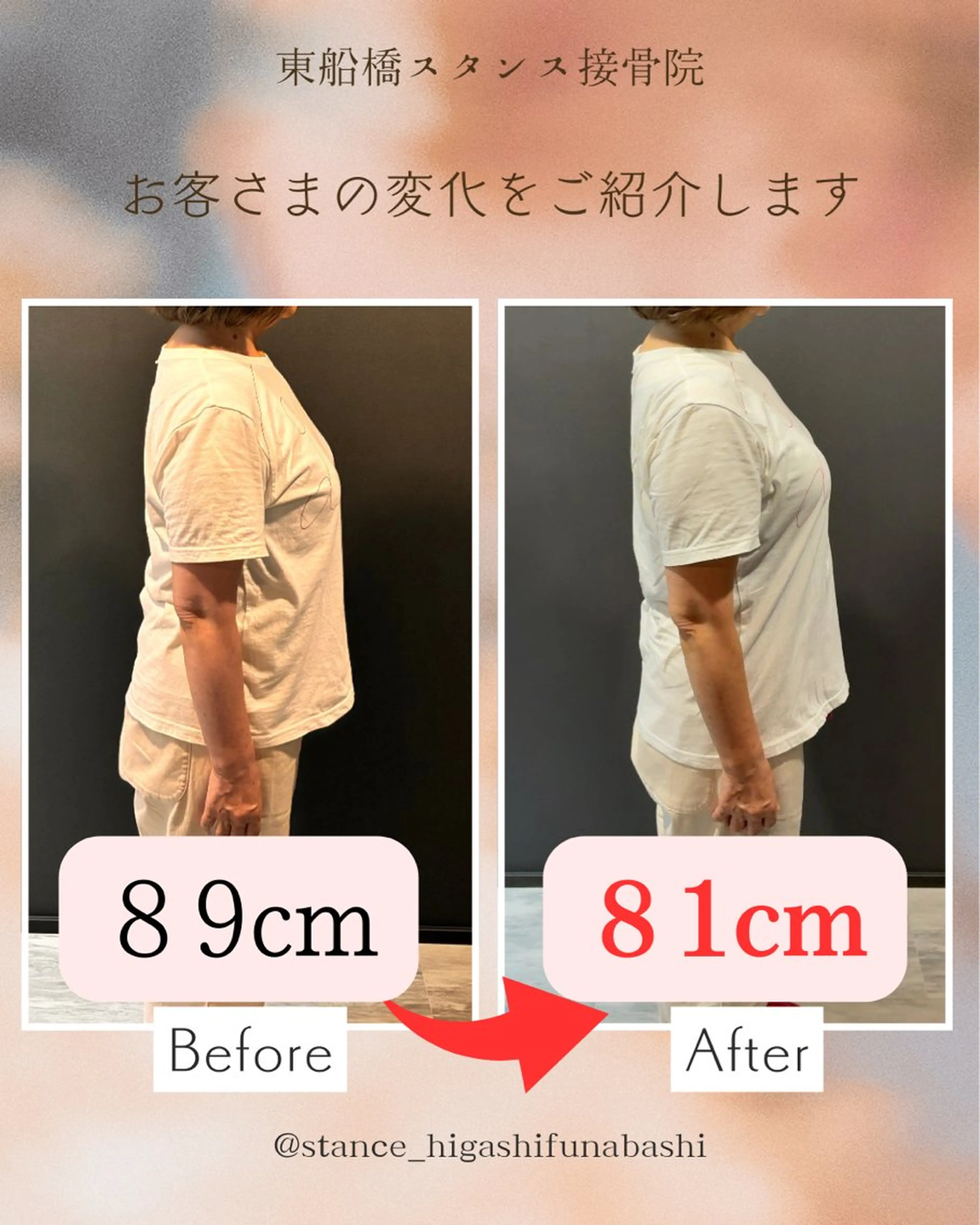 【4月残り4名限定！】平均8kg痩せる体質改善ダイエット！年間500kg以上痩せた！辛い食事制限と運動必要なし！モニターの写真