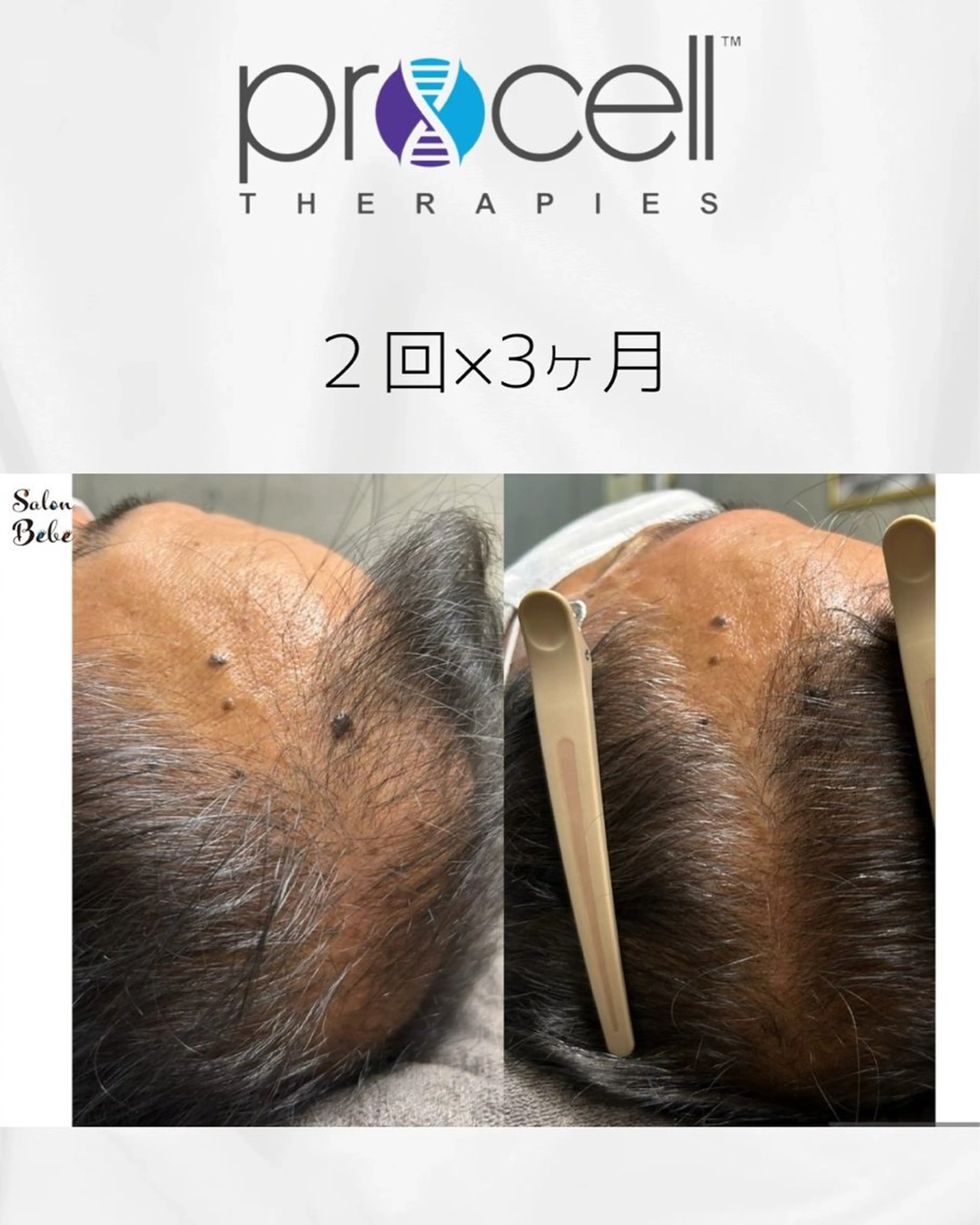 エステ Salon Bebe 名古屋のエステ・リラクイメージ