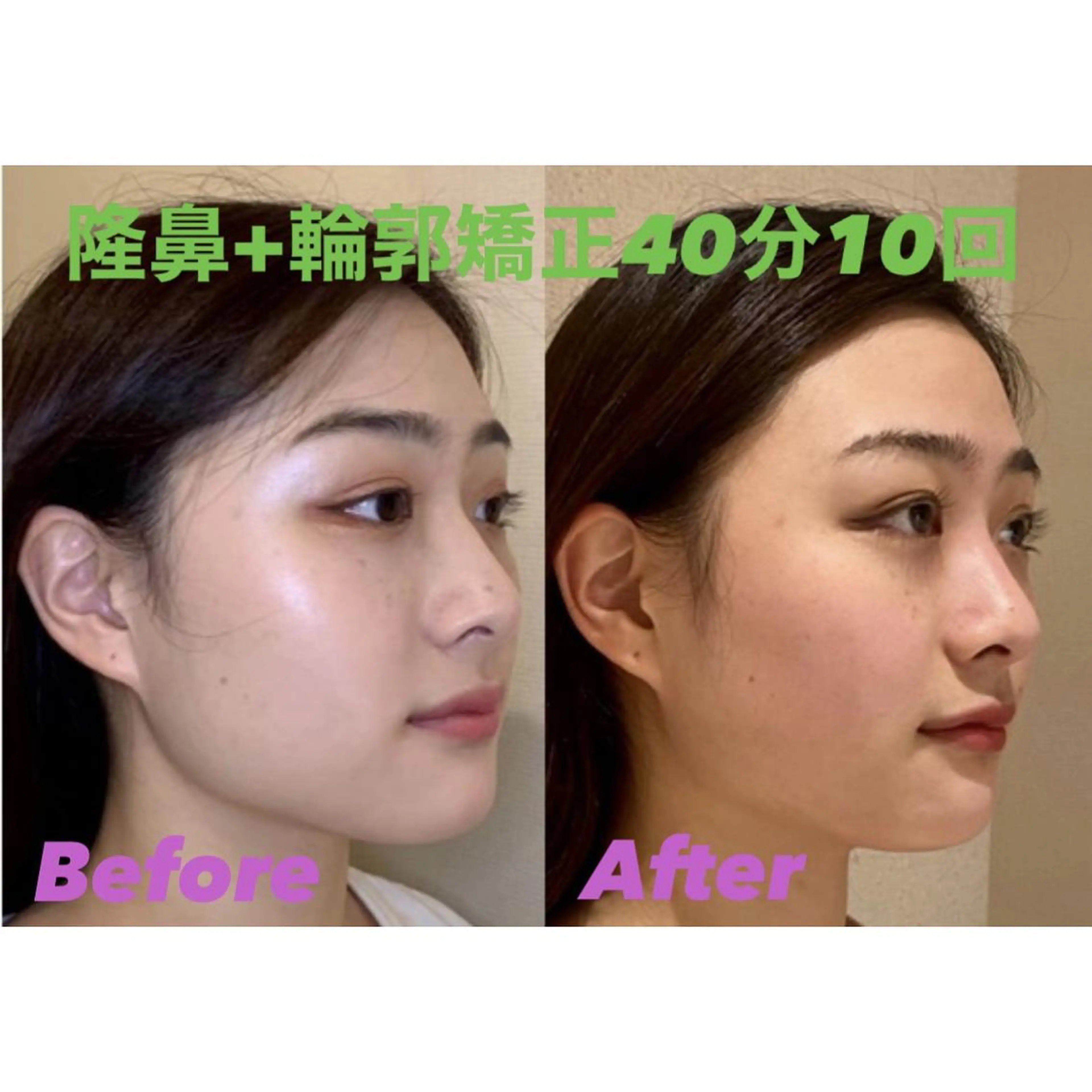 隆鼻矯正専門店ラプリ 古越のエステ・リラクイメージ