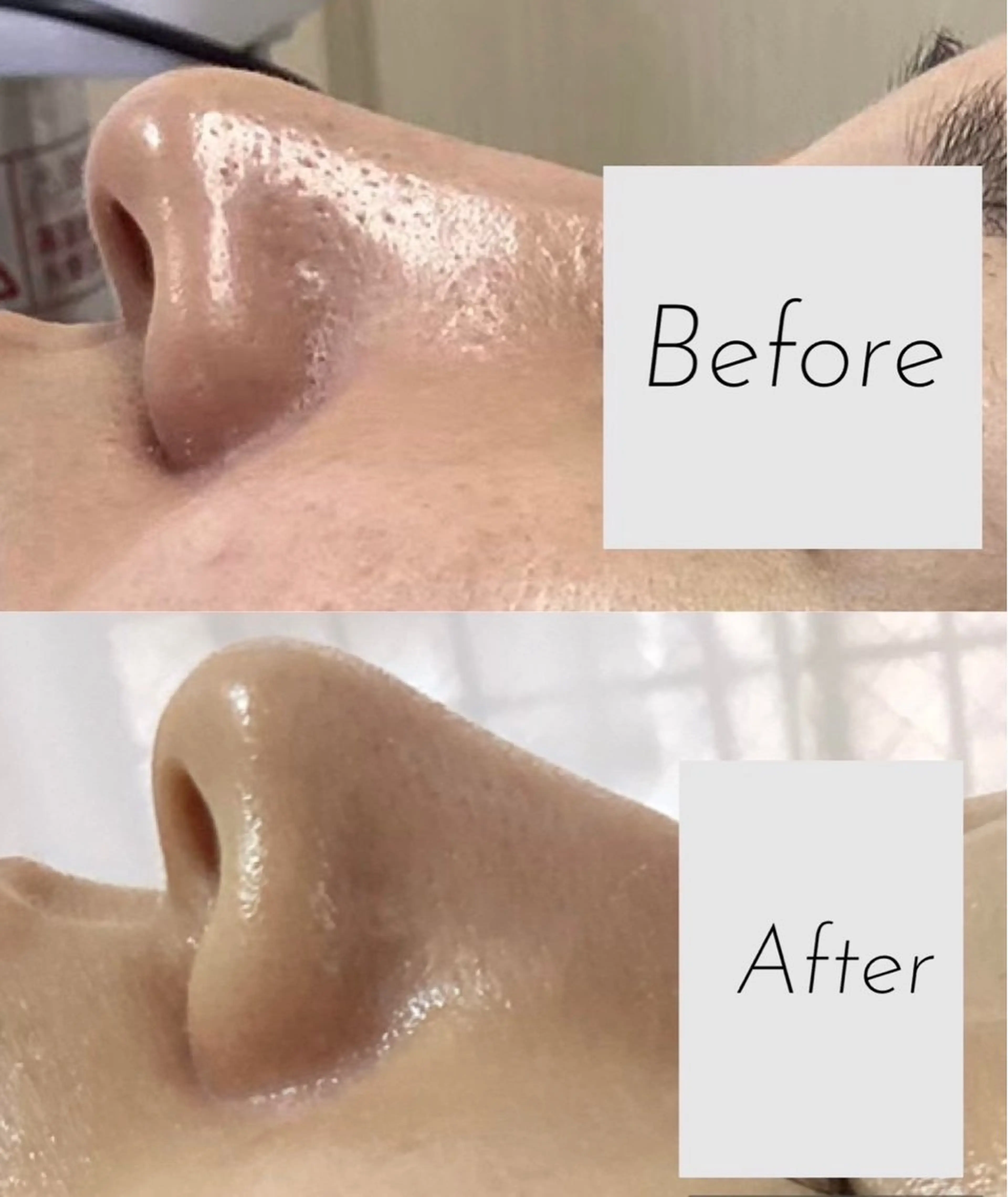 エステ 都度払い 肌質改善専門サロンのエステ・リラクイメージ