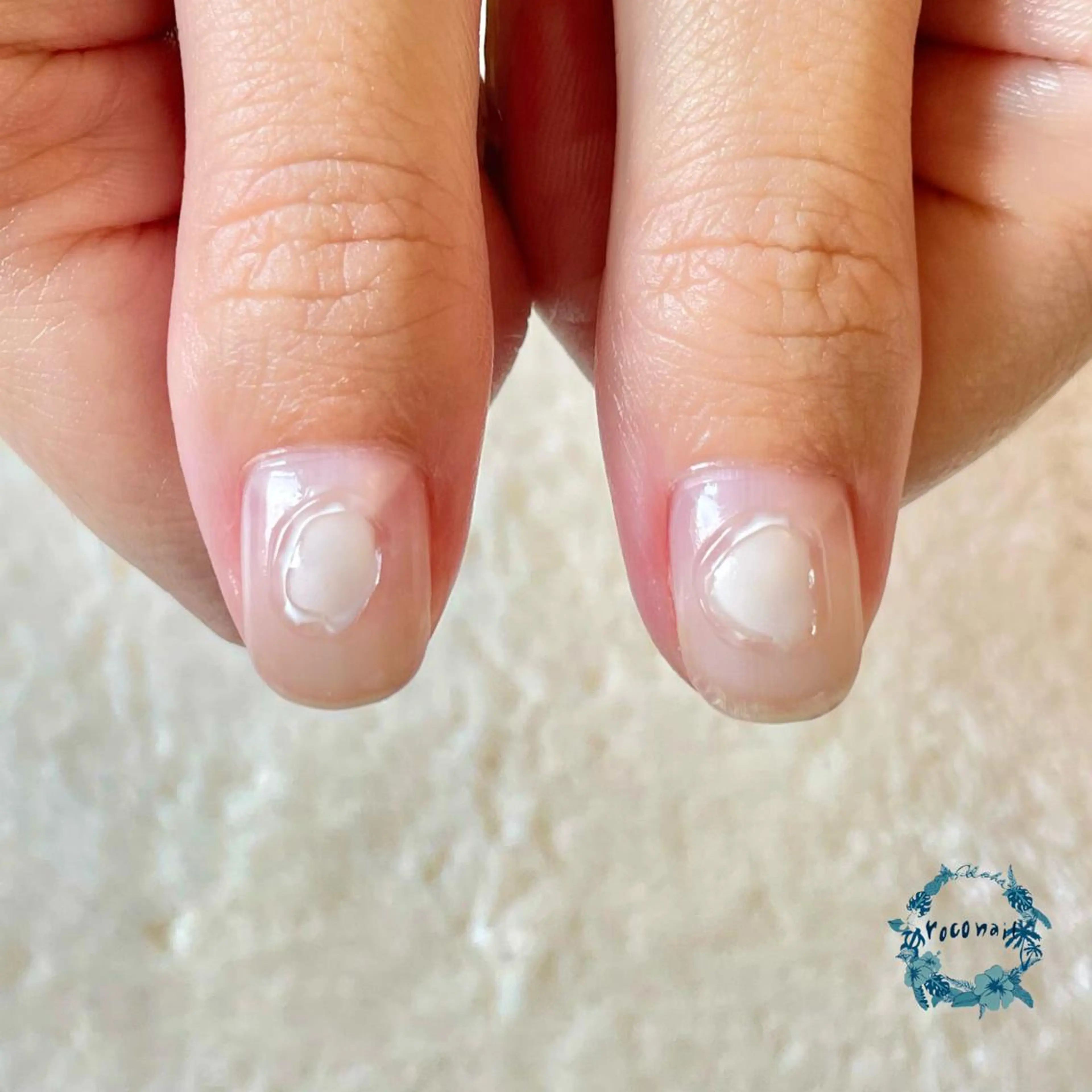 ネイル ぷっくりネイル ハンドネイル roconail ヒロコのネイルデザイン