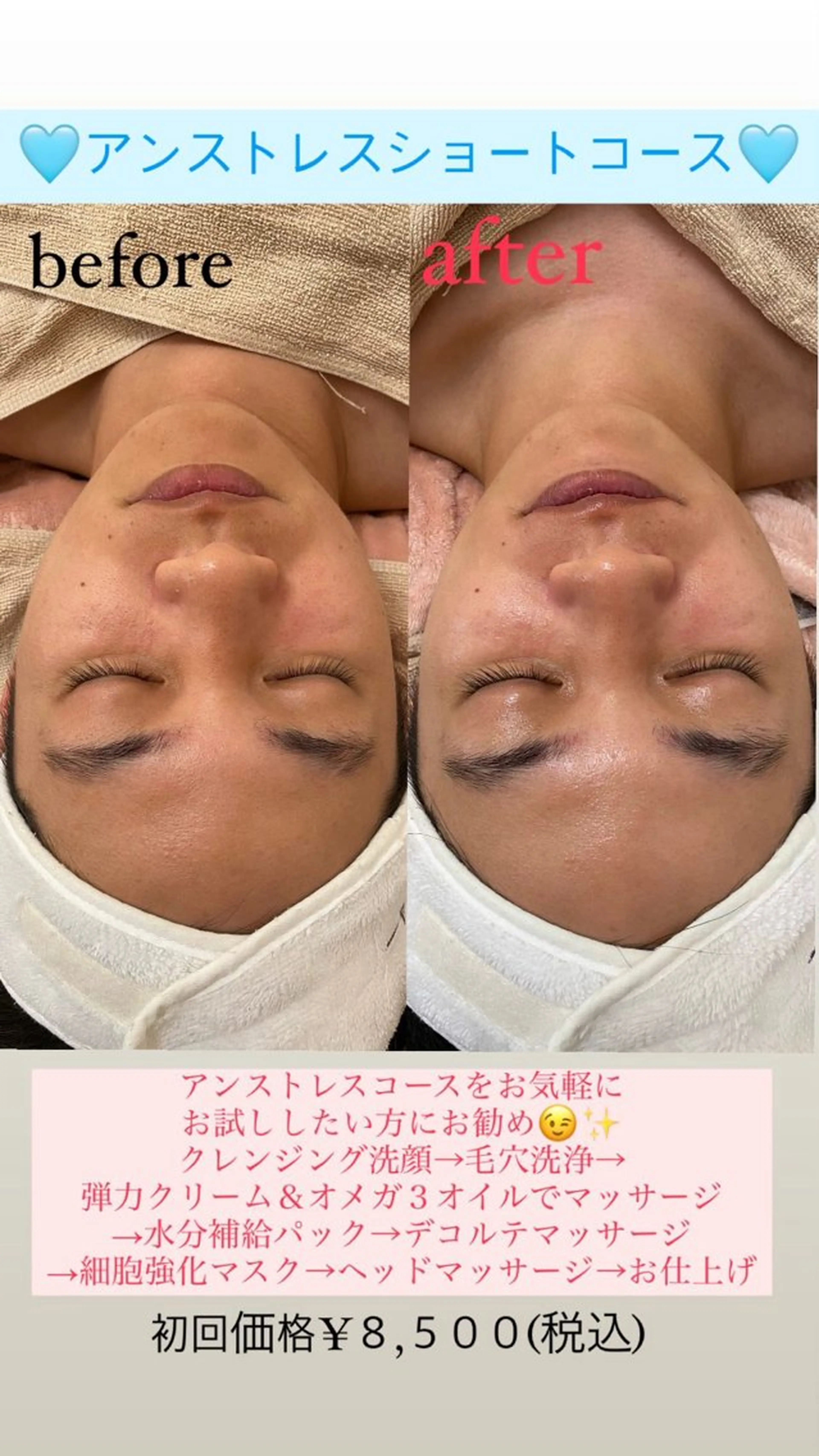 メンズ エステ Salon de Lino 御器所のエステ・リラクイメージ