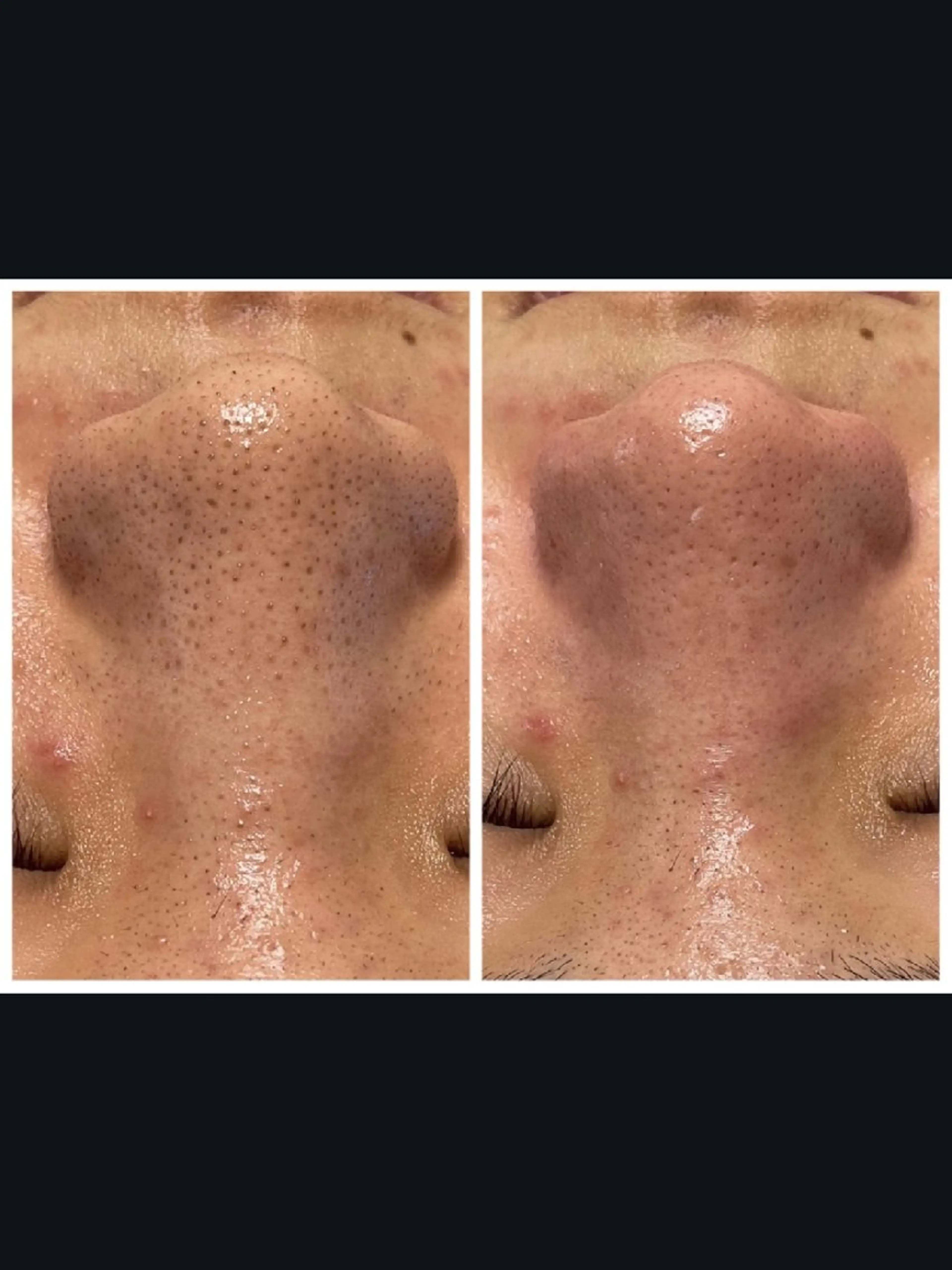 エステ Abe Yukaのエステ・リラクイメージ