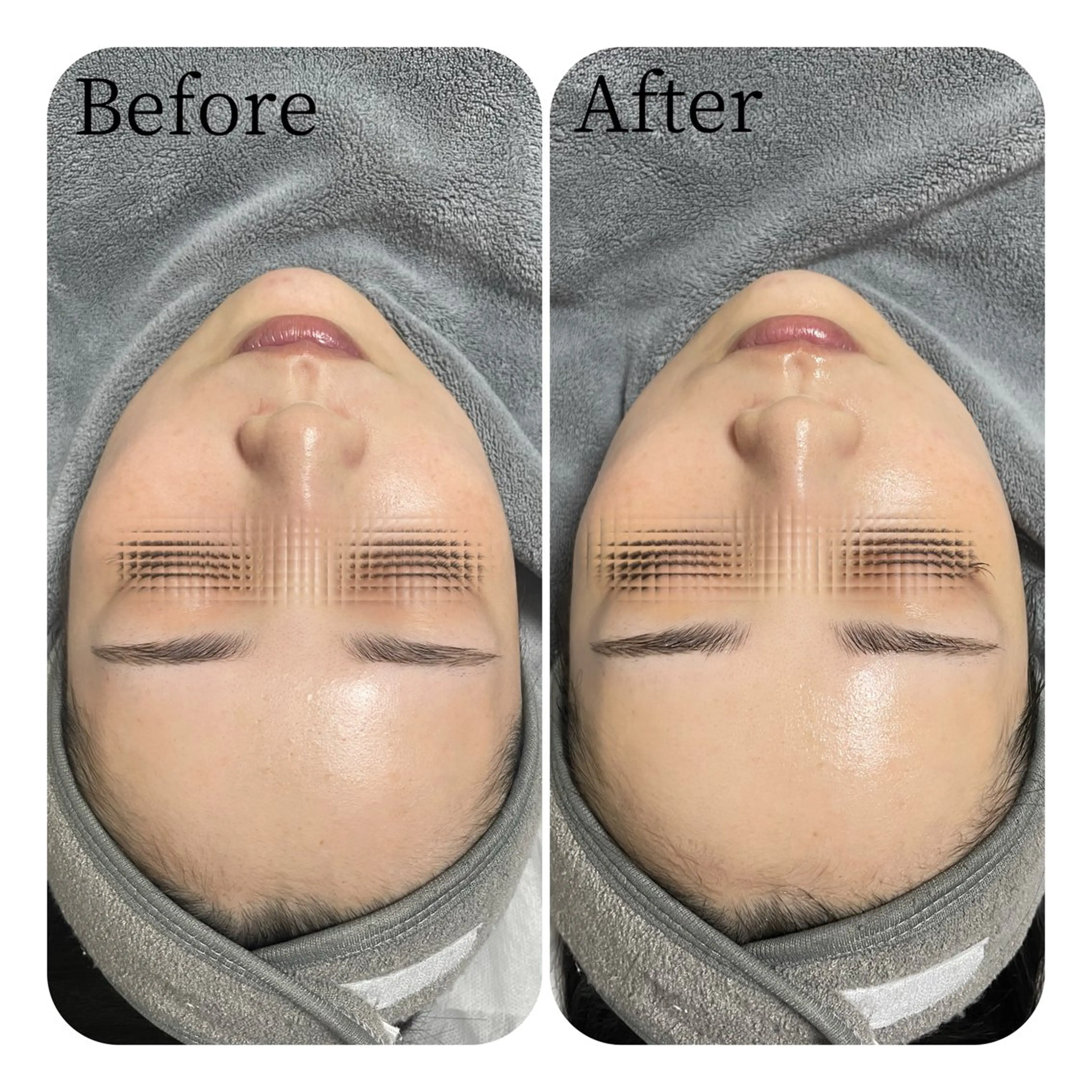 エステ Éclat de Belle🫧白玉肌のその他イメージ