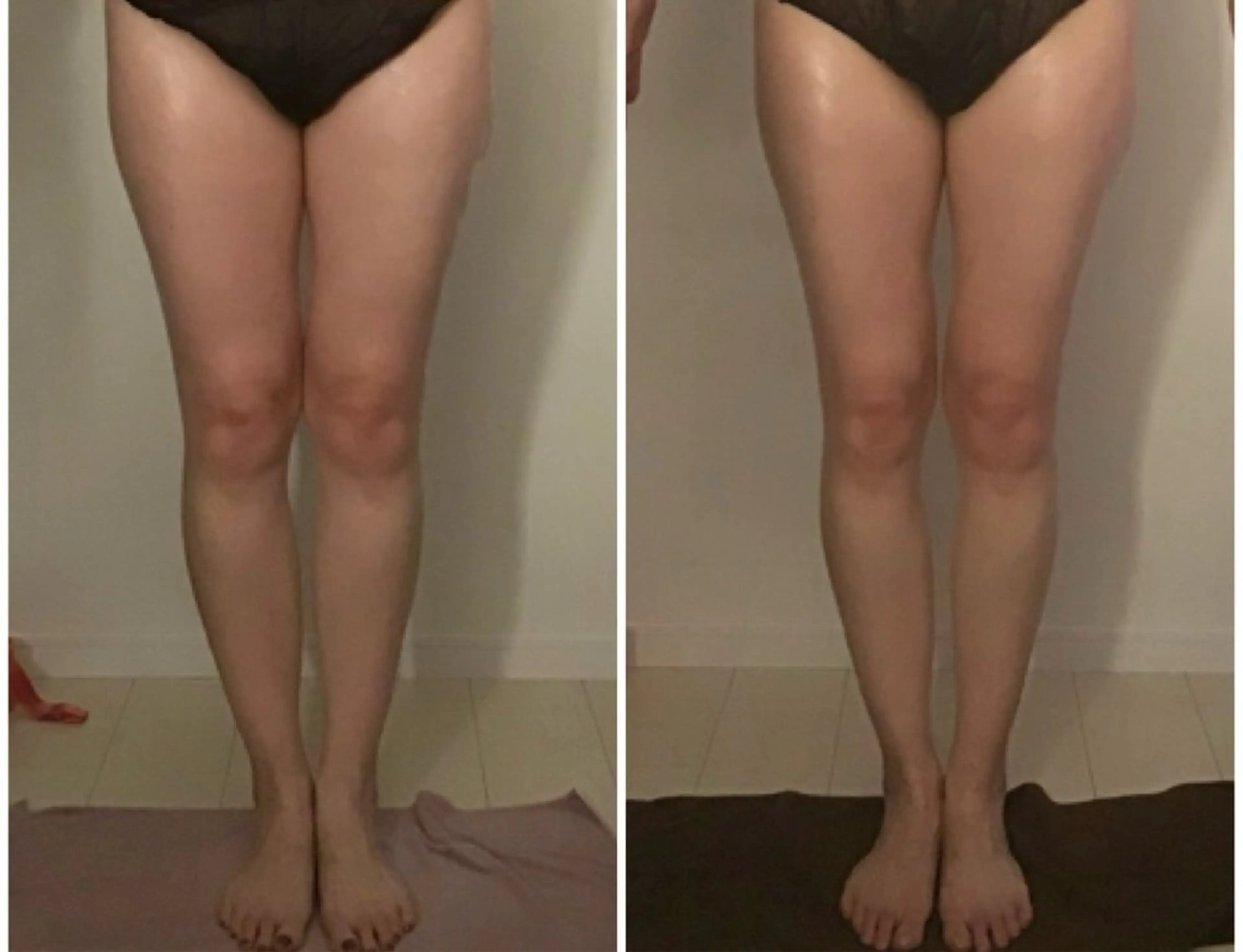 エステ リラク BELLEFINE 💕痩身・小顔・脱毛のエステ・リラクイメージ