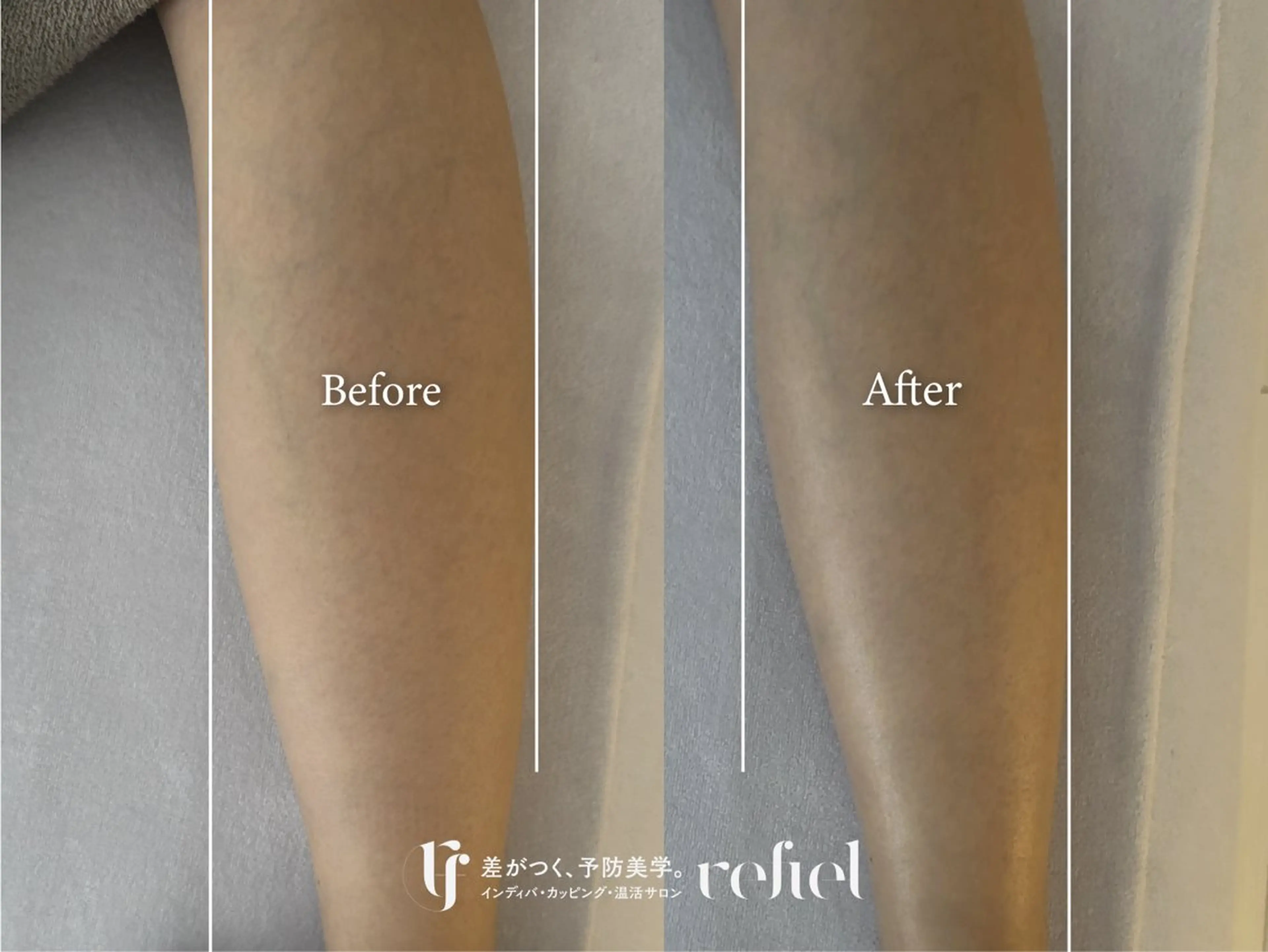 refiel たまプラーザ店所属・藤井 りさのエステ・リラクイメージ