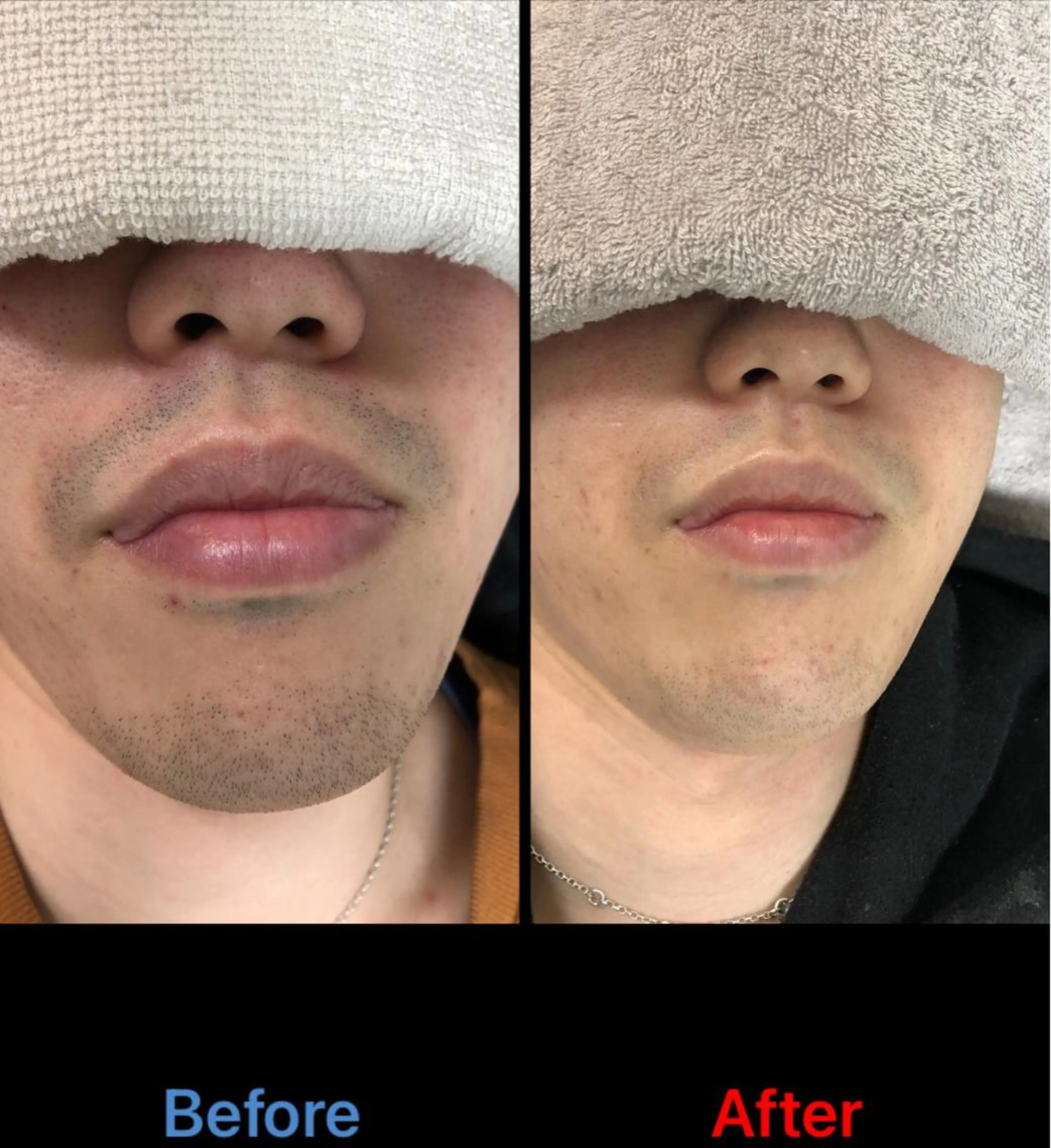 メンズ 脱毛 武元 大樹のエステ・リラクイメージ