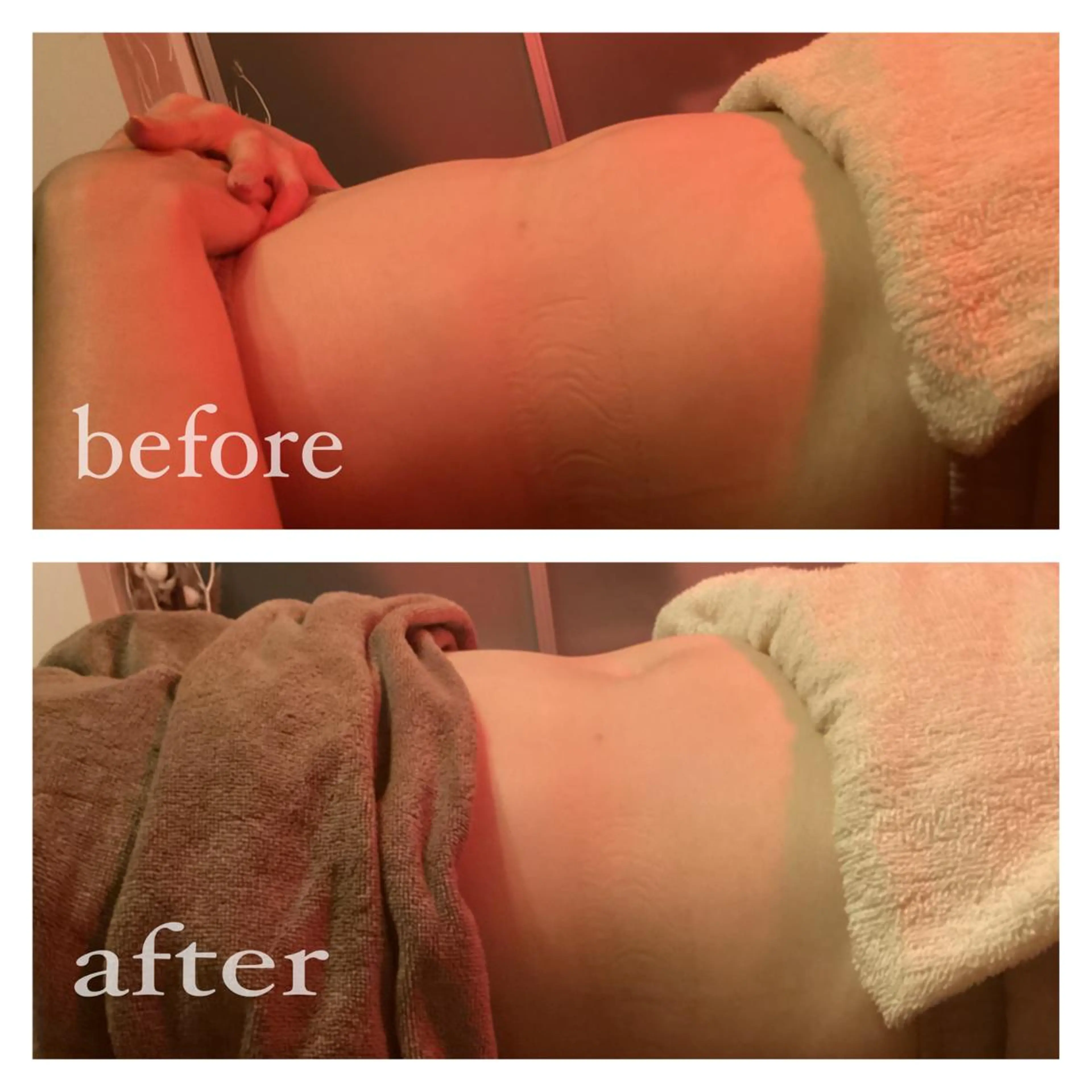 美腸専門 漢方よもぎ蒸しのエステ・リラクイメージ