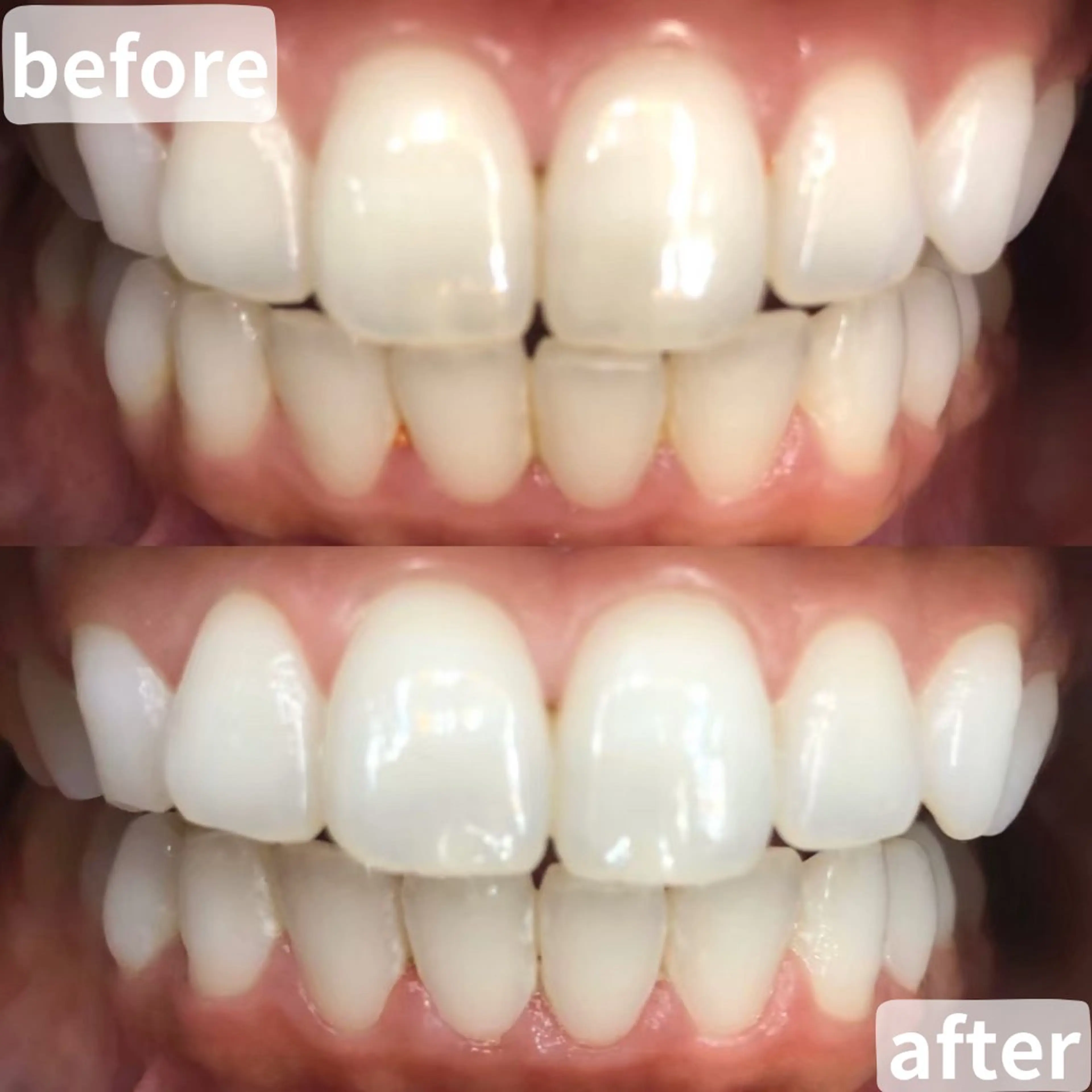 LBSホワイトニング桶川店所属・LBSホワイトニング 桶川店のエステ・リラクイメージ