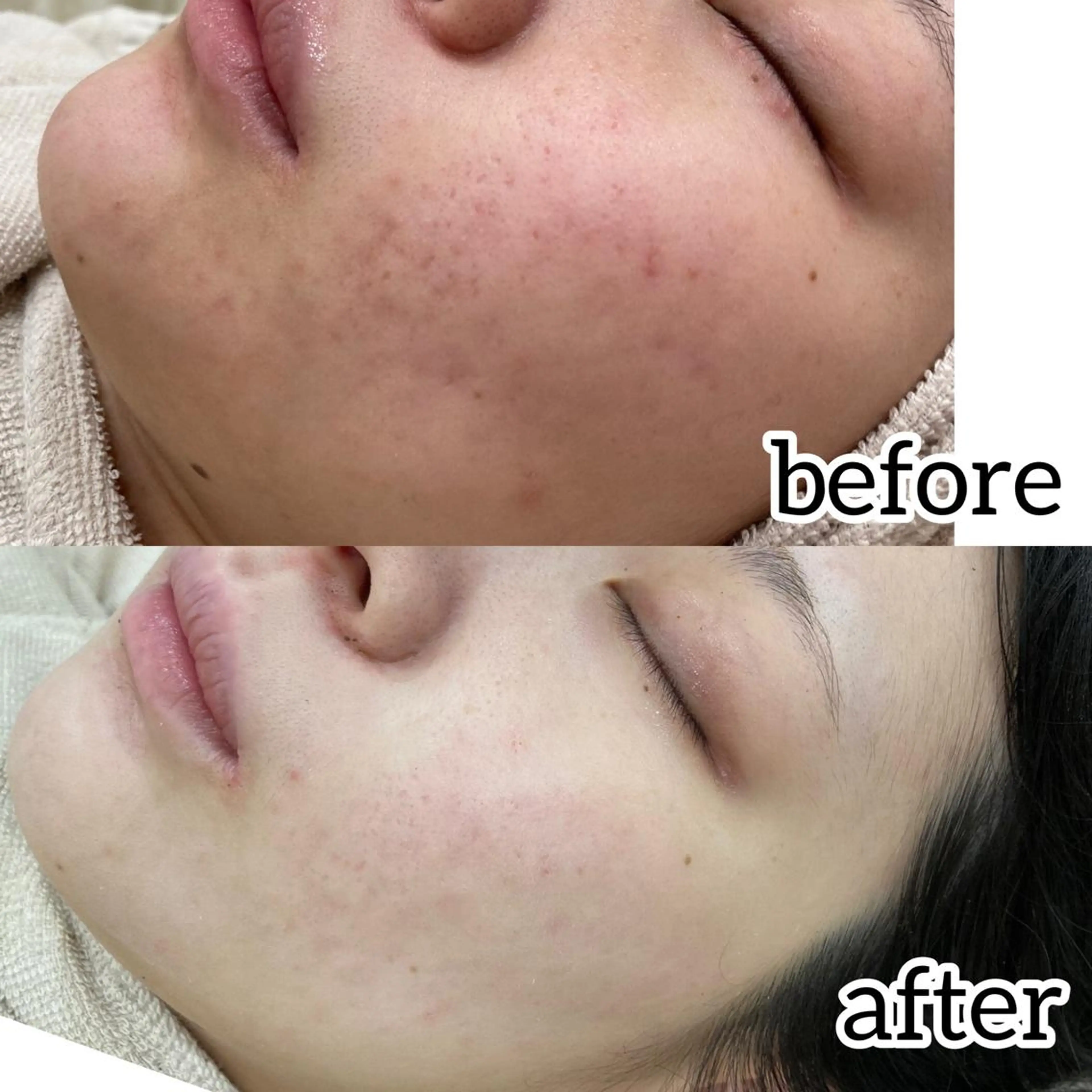 laluna saki...のその他イメージ