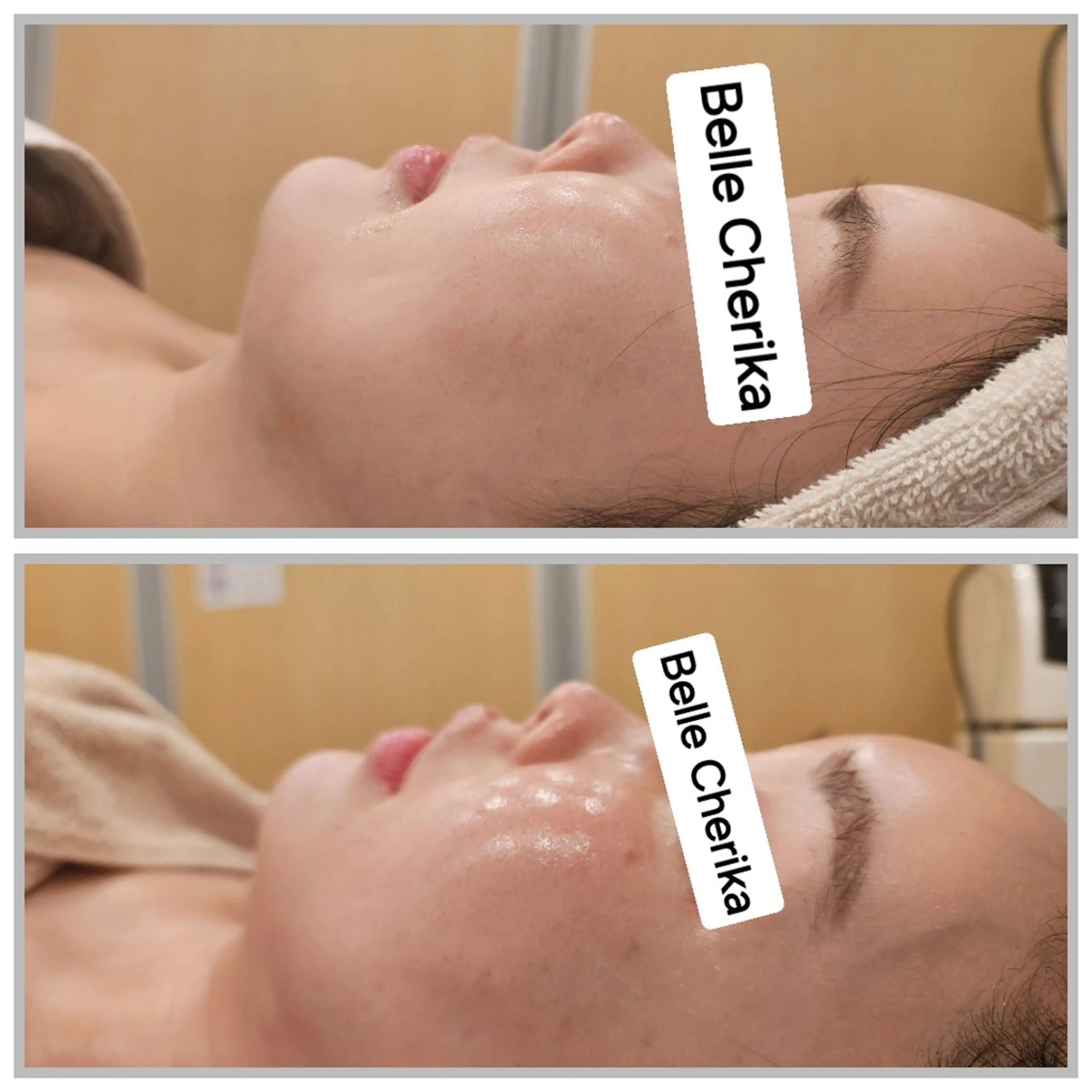 エステ ベル チェリカ 三城のエステ・リラクイメージ