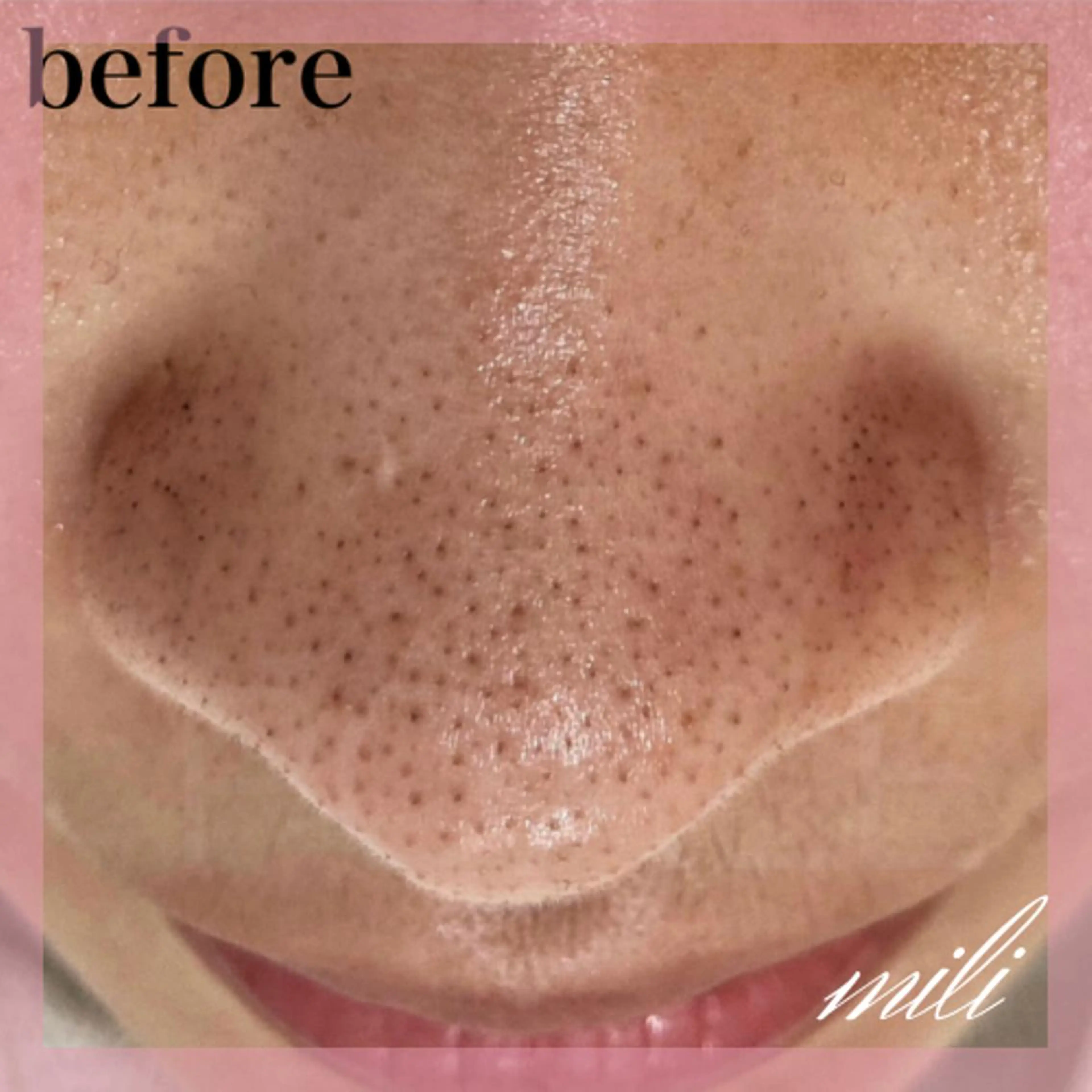 エステ 【毛穴ケア専門店✨】 mili 須藤歩華のエステ・リラクイメージ