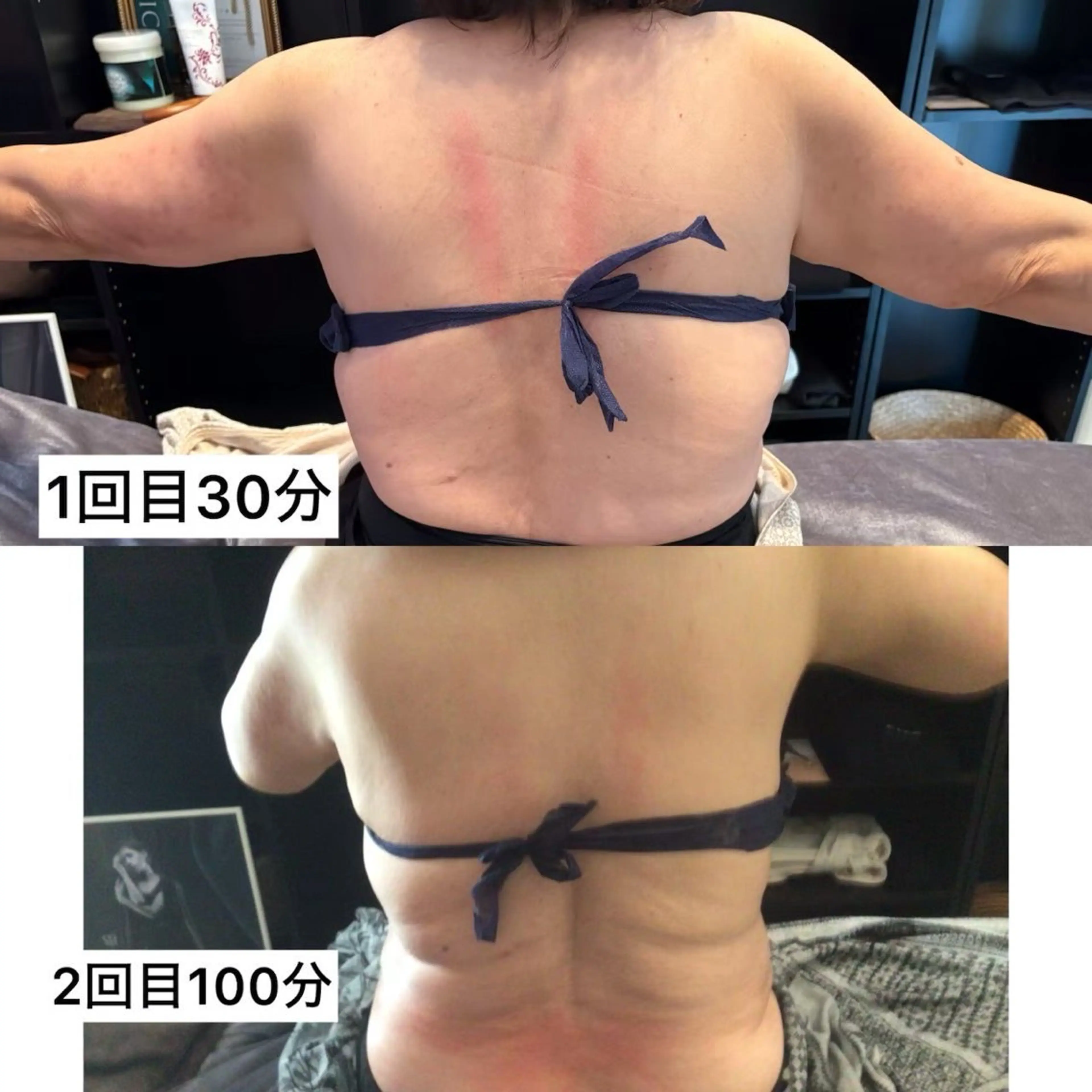 エステ 浮腫|肩こり|張り 日々の疲れを解消★のエステ・リラクイメージ