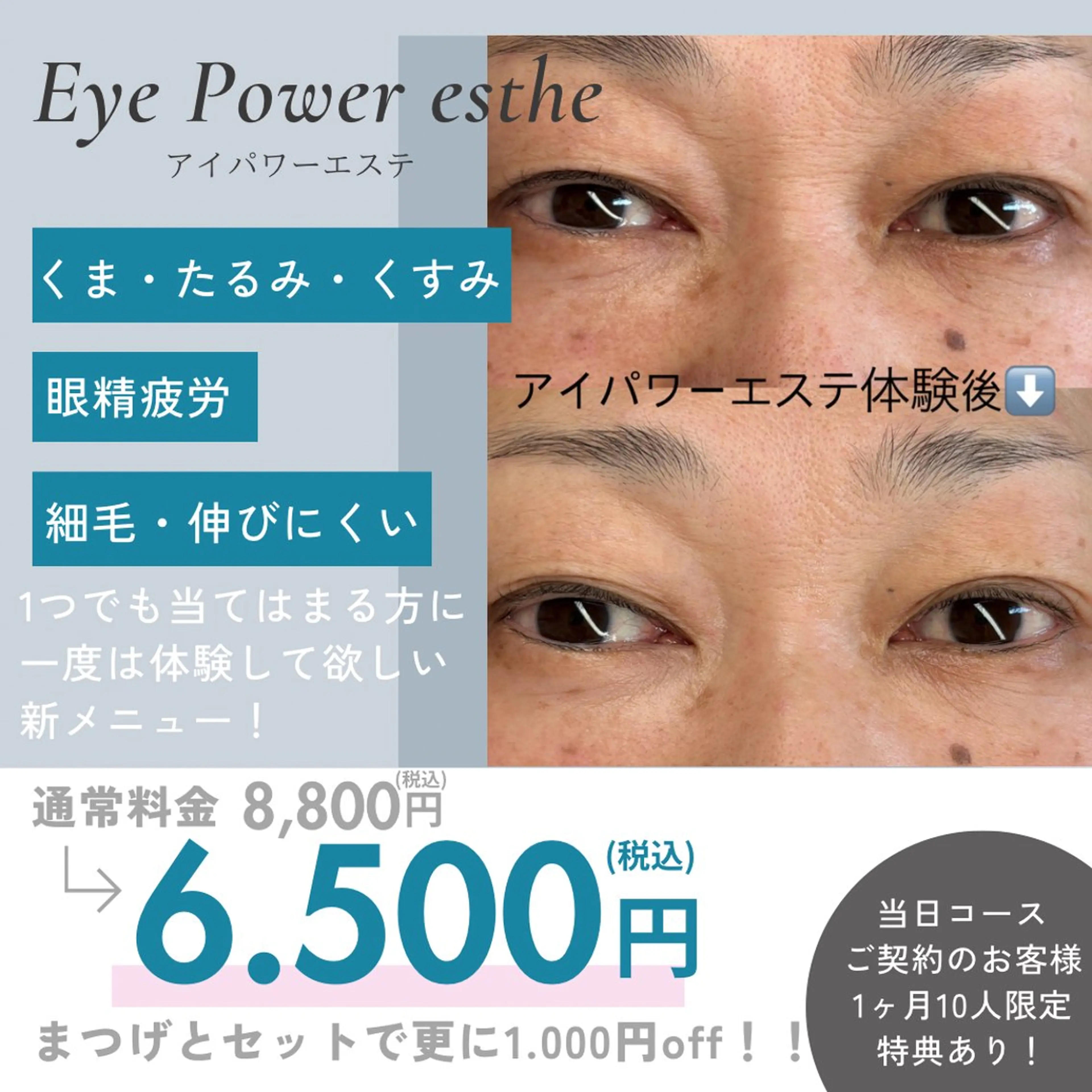 エステ n Yukari.のマツエク・マツパデザイン