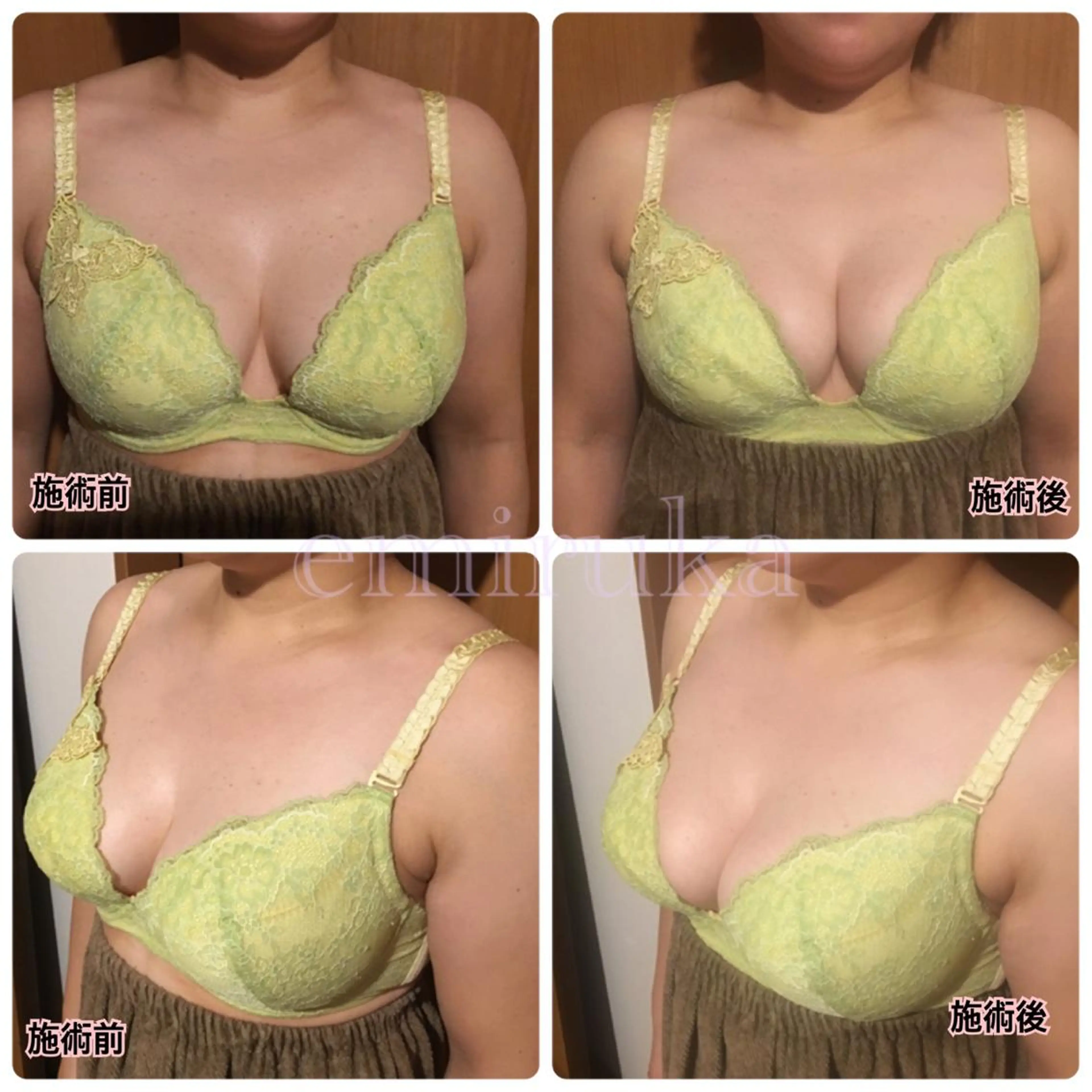 バストアップサロン エミルカのその他イメージ