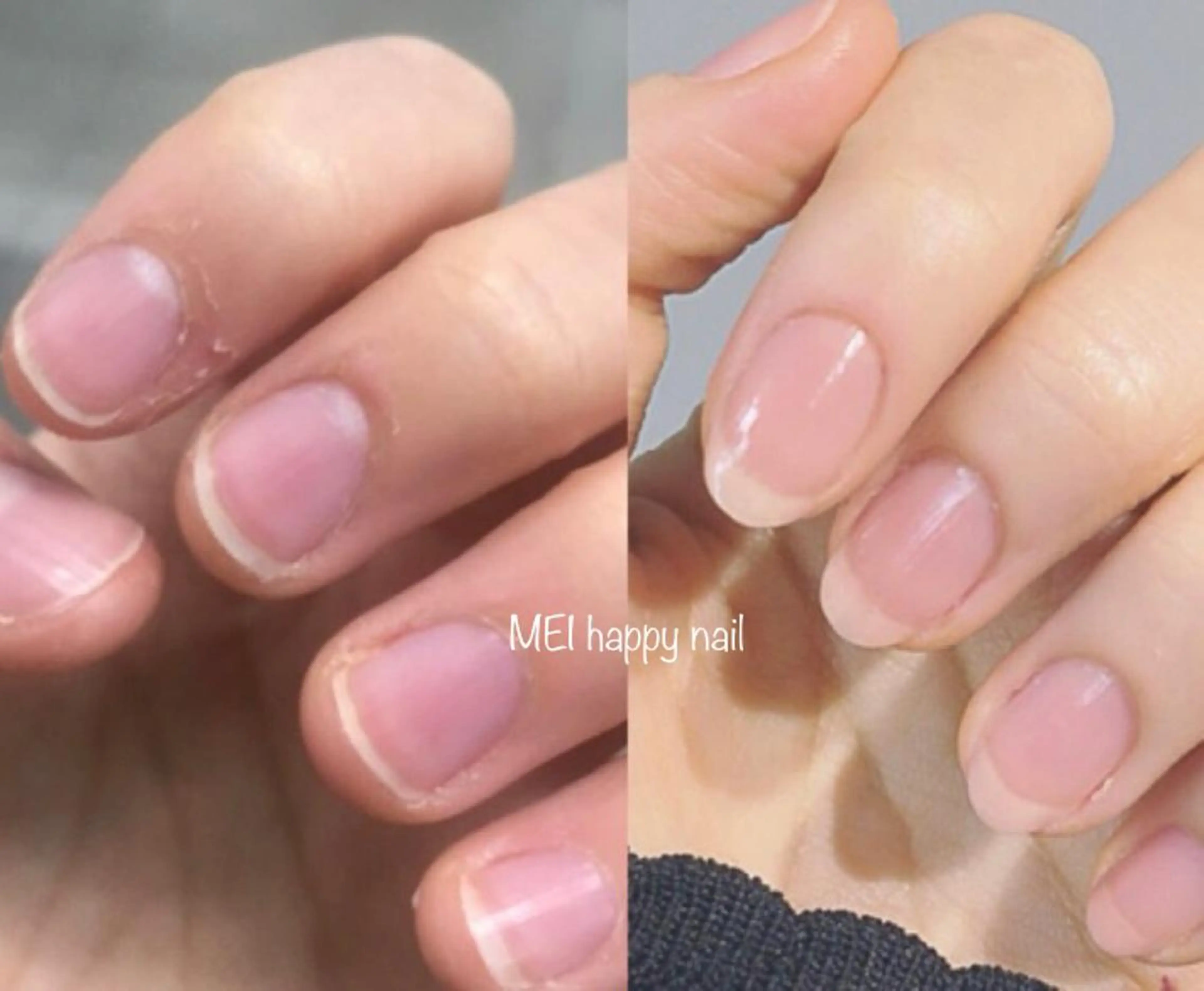 ネイル 北浦和 自爪育成ケアのネイルデザイン