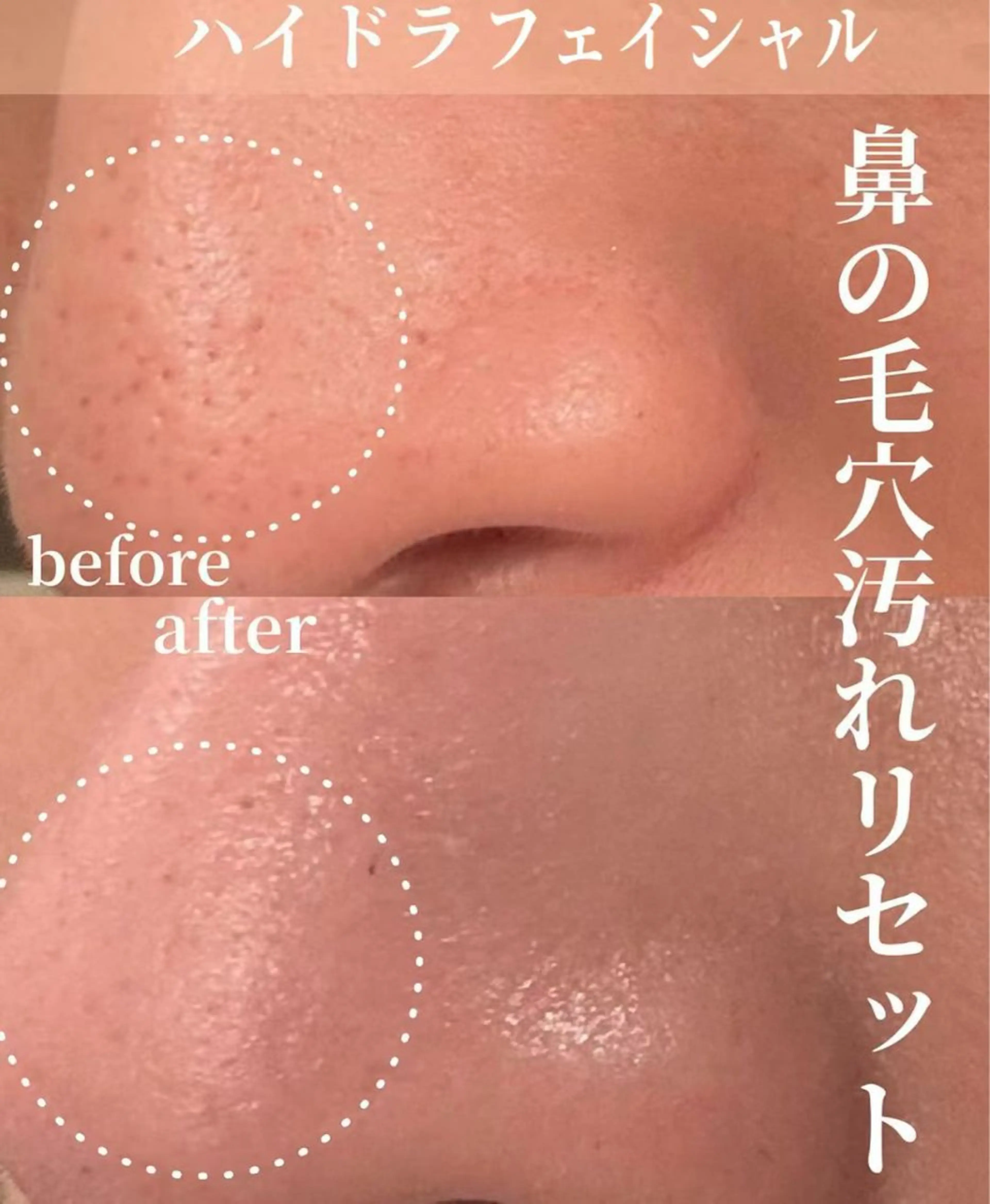 赤羽Stars beautyのエステ・リラクイメージ